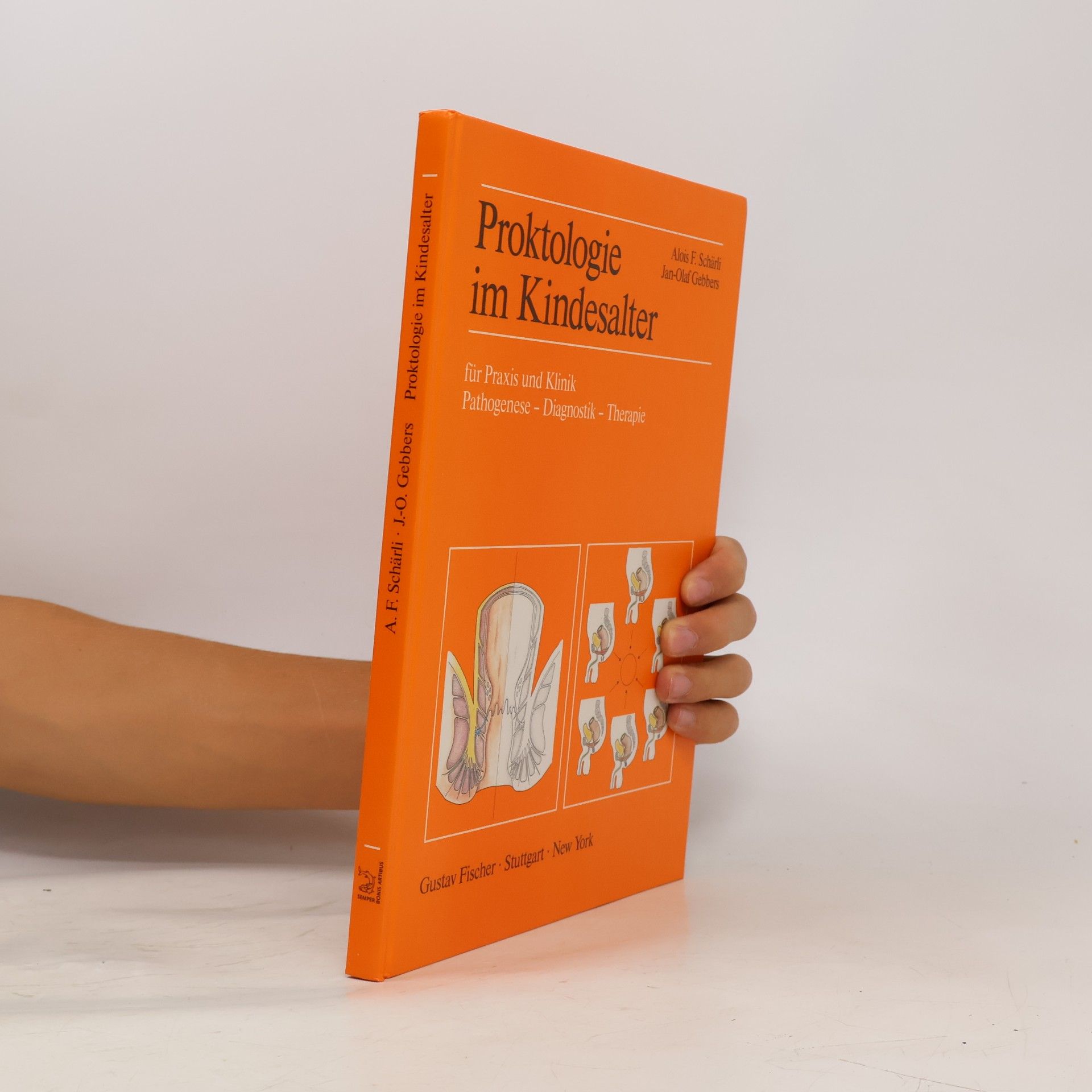 Proktologie im Kindesalter