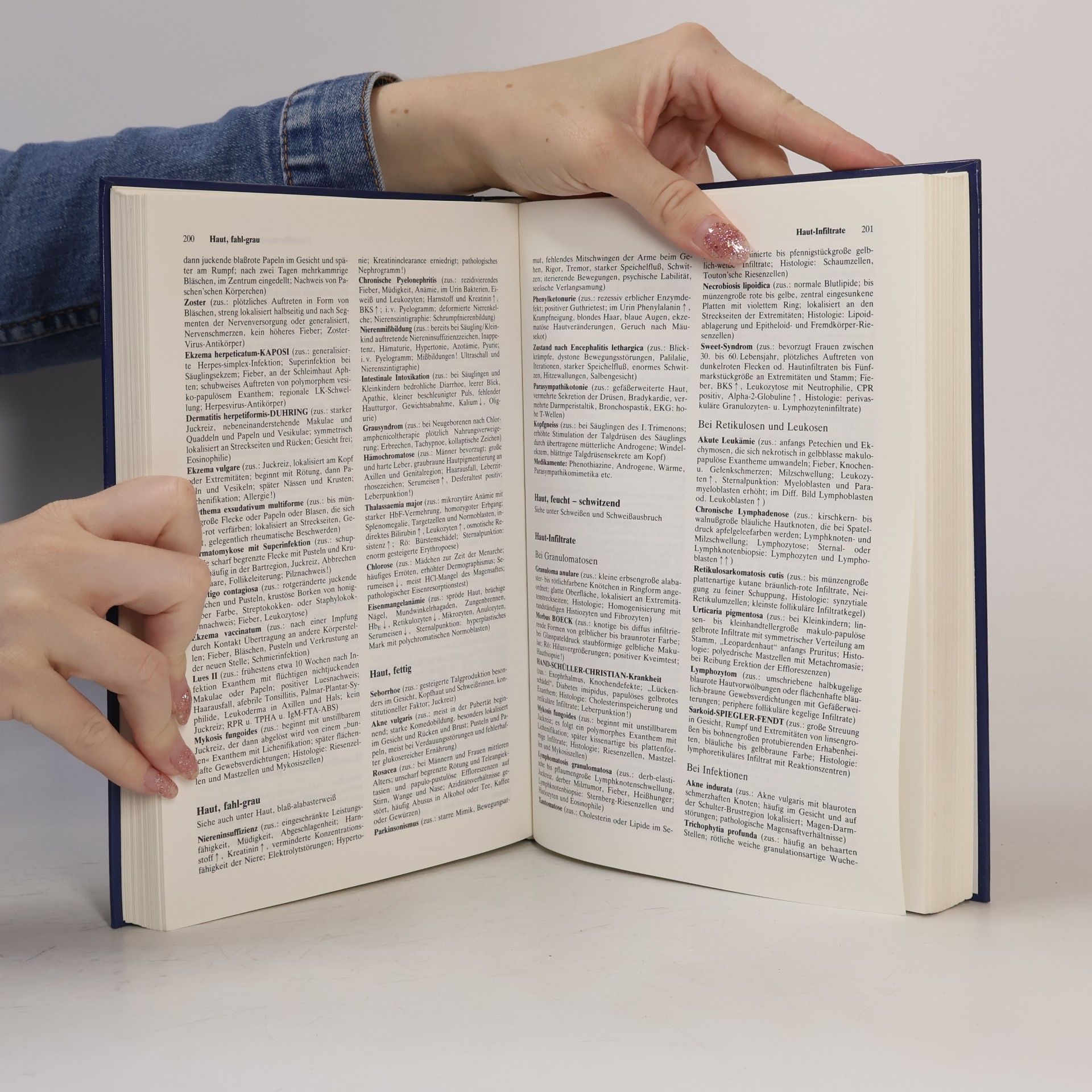 Hans Vogl Differentialdiagnose der medizinisch-klinischen Symptome. Lexikon der klinischen Krankheitszeichen und Befunde.