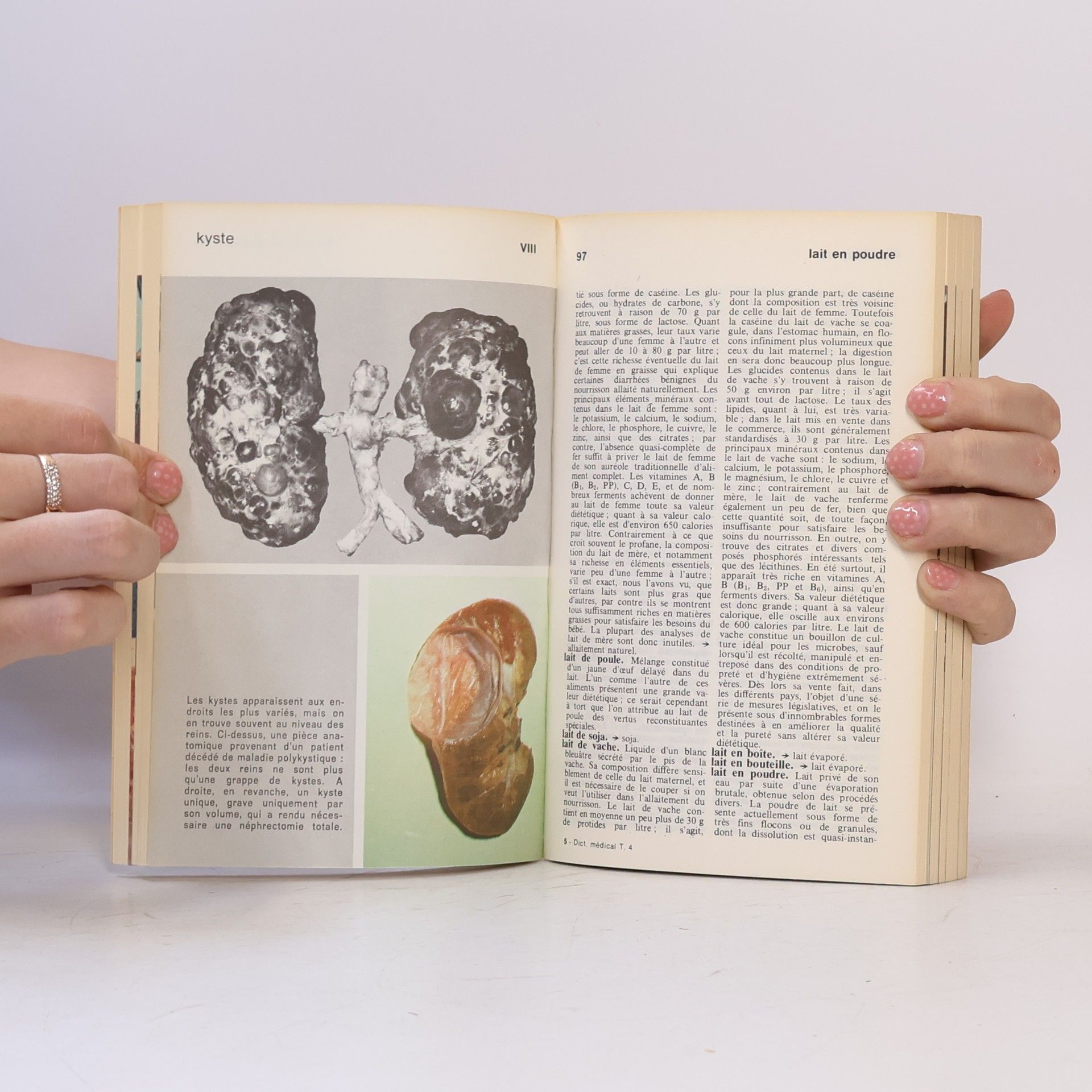 Autorenkollektiv Le dictionnaire Marabout de la Médecine 4