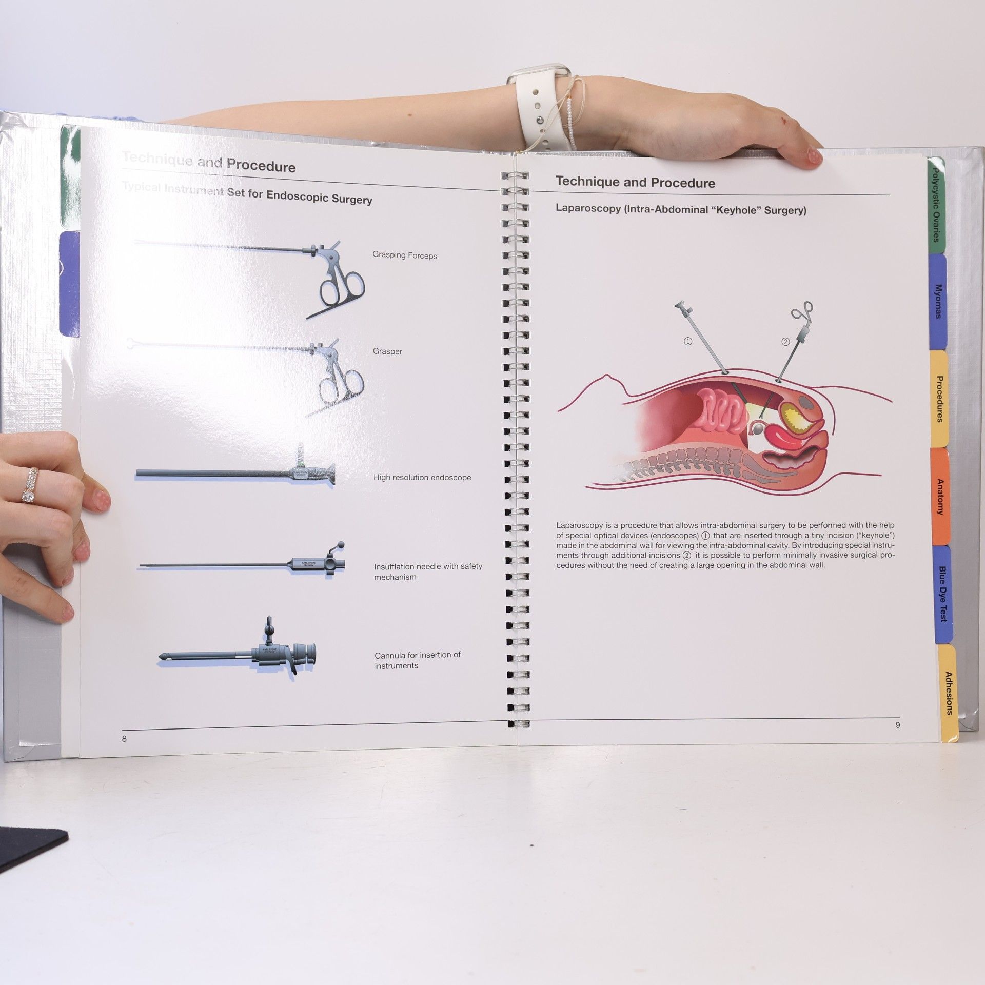 Ulrich Karck Endoscopic Surgery in Gynecology - 1: Laparoscopy