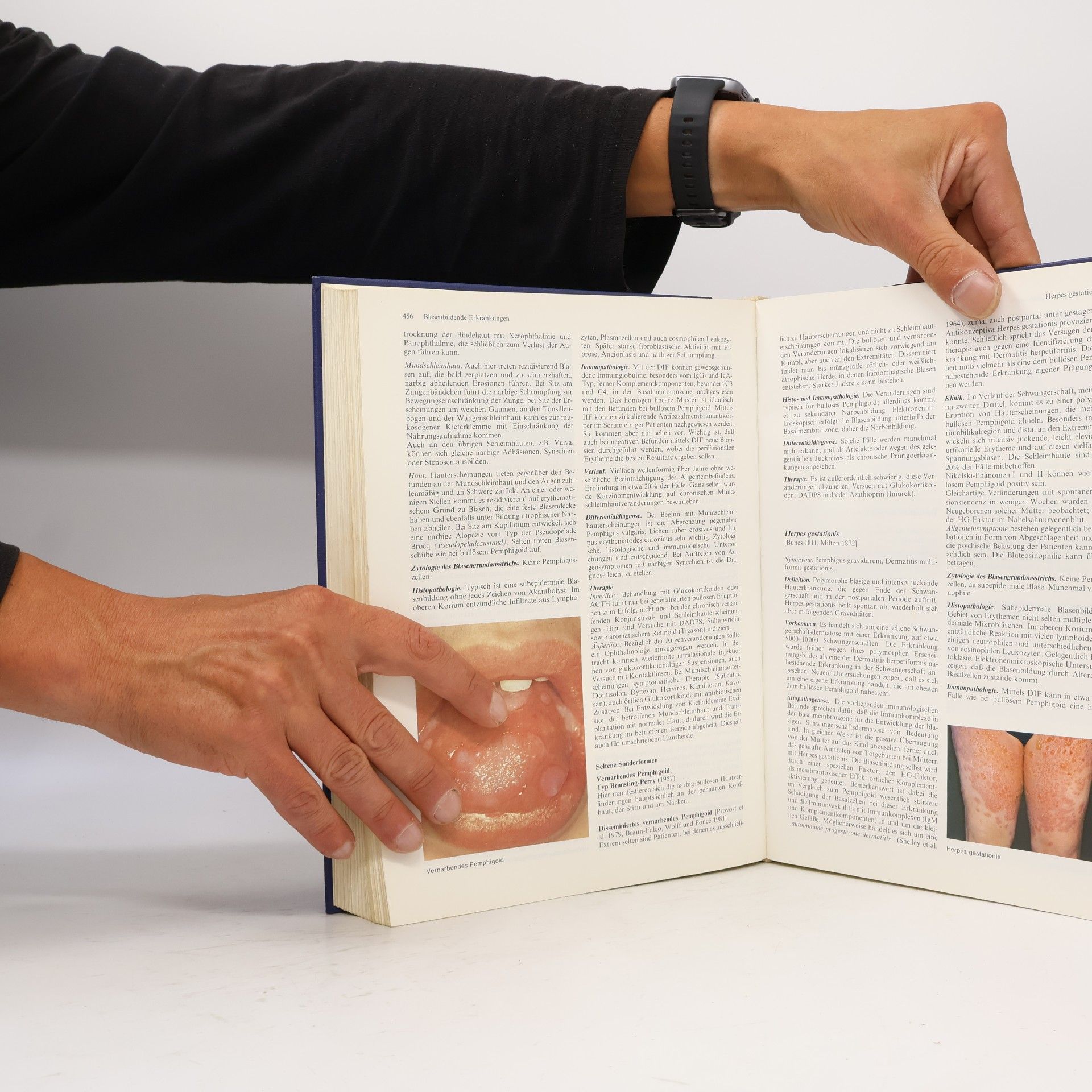 Otto Braun-Falco Dermatologie und Venerologie