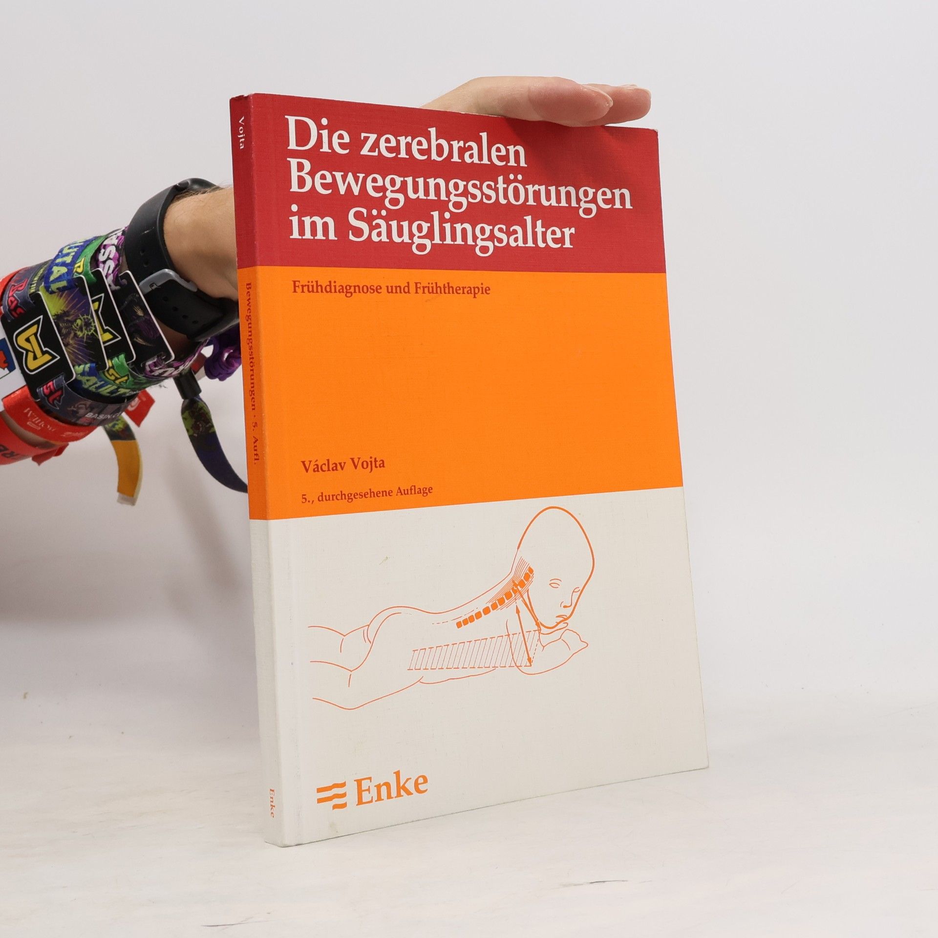Die zerebralen Bewegungsstörungen im Säuglingsalter
