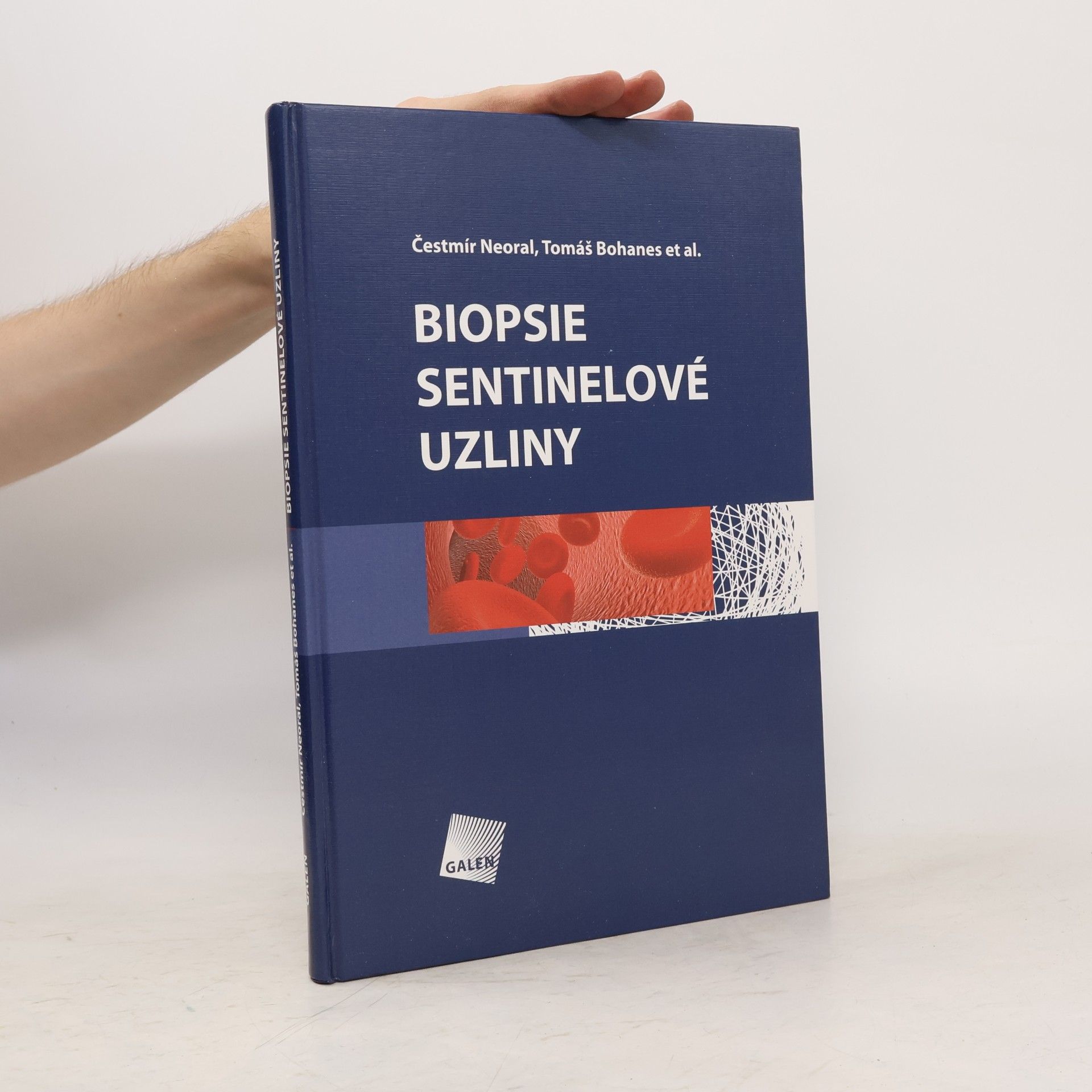 Tomáš Bohanes Biopsie sentinelové uzliny