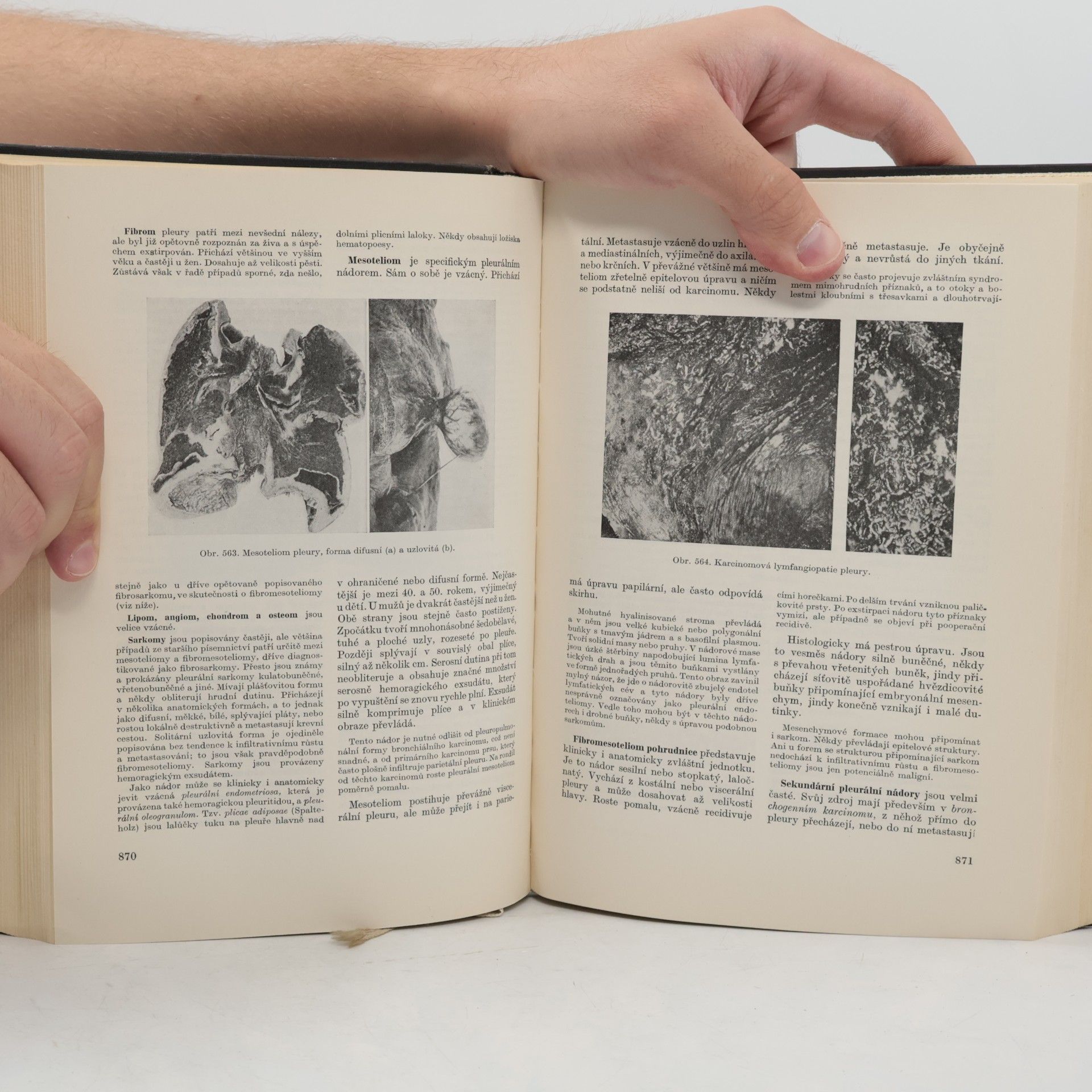 Blahoslav Bednář Patologická anatomie (2. díl, část první)