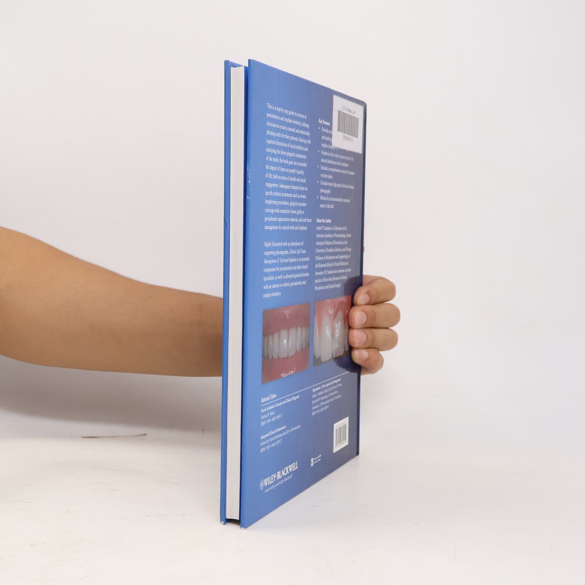André P. Saadoun Esthetic Soft Tissue Management of Teeth and Implants