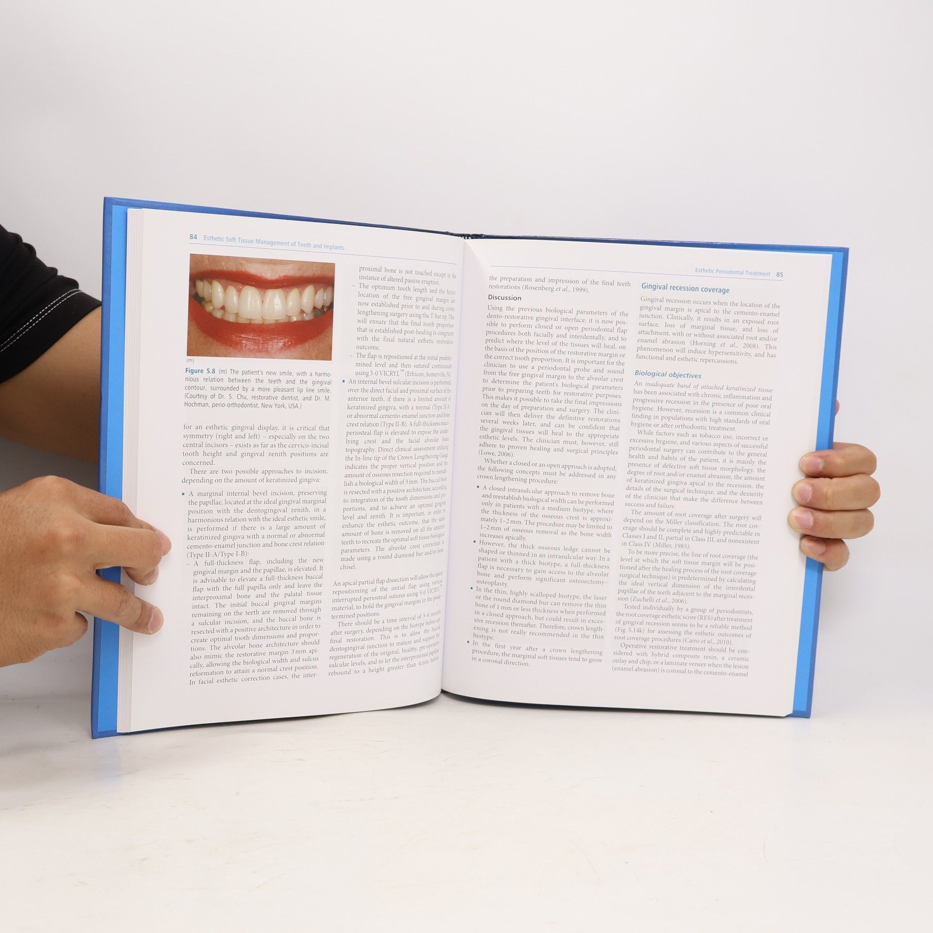 André P. Saadoun Esthetic Soft Tissue Management of Teeth and Implants