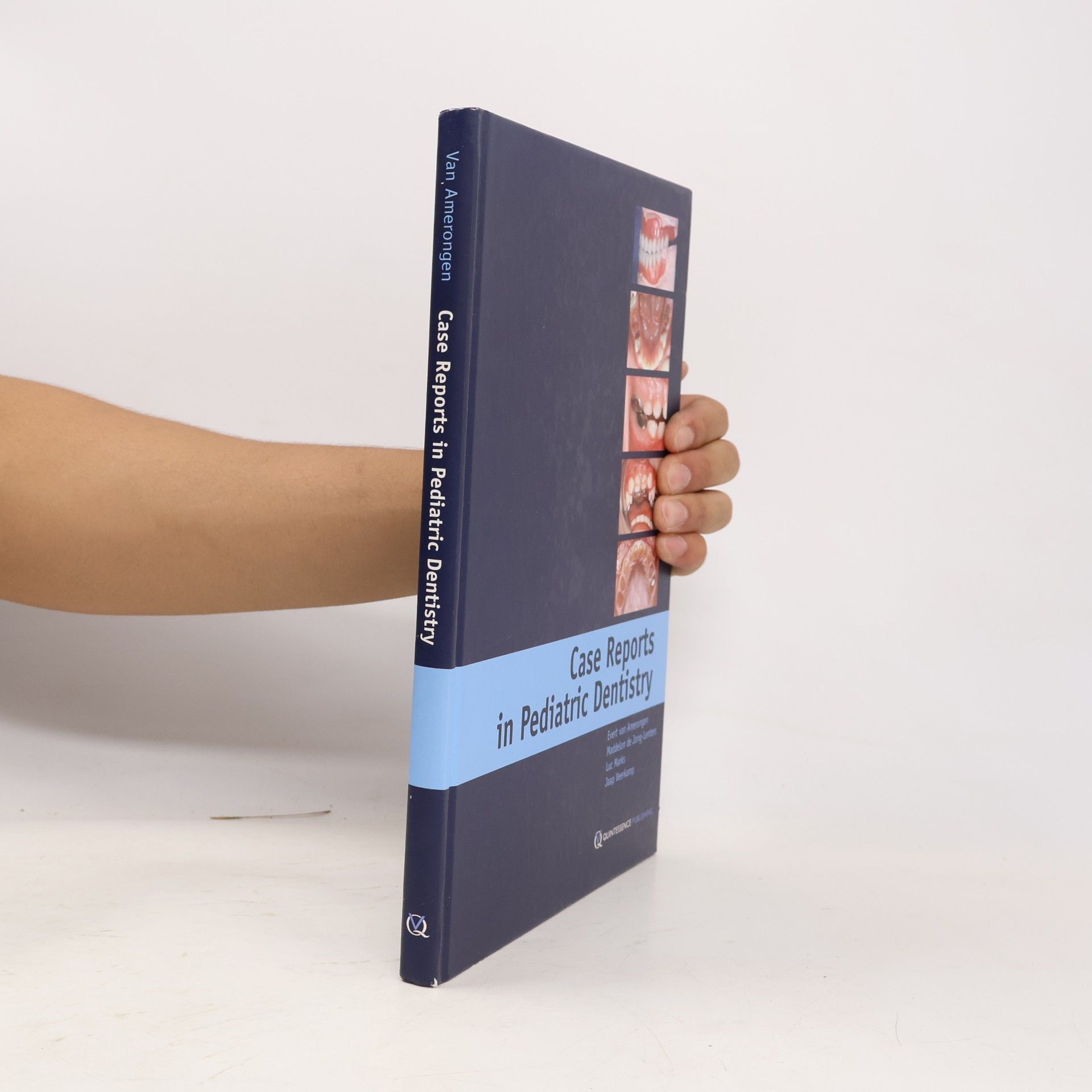 Jaap Veerkamp Case Reports in Pediatric Dentistry