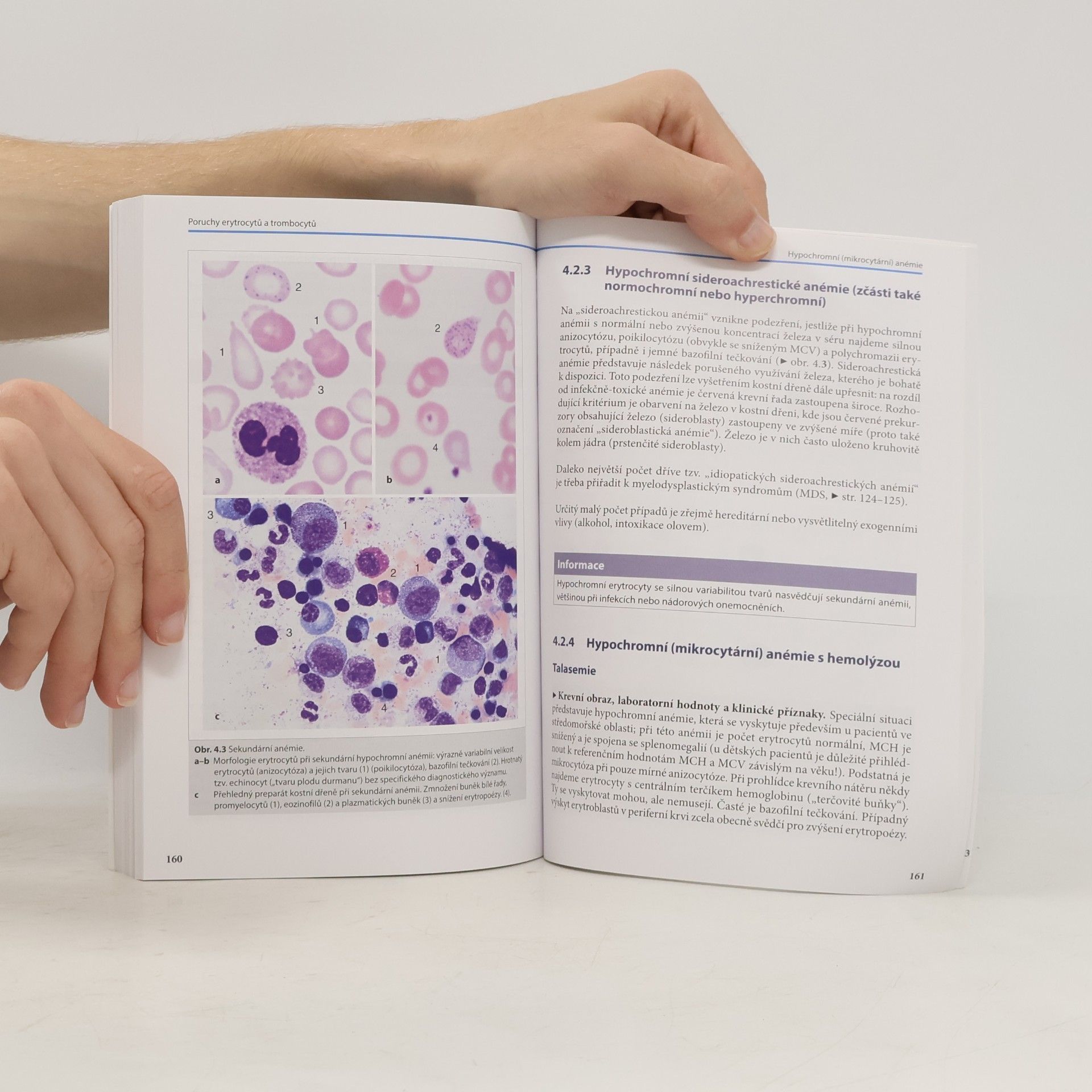 Torsten Haferlach Kapesní atlas hematologie