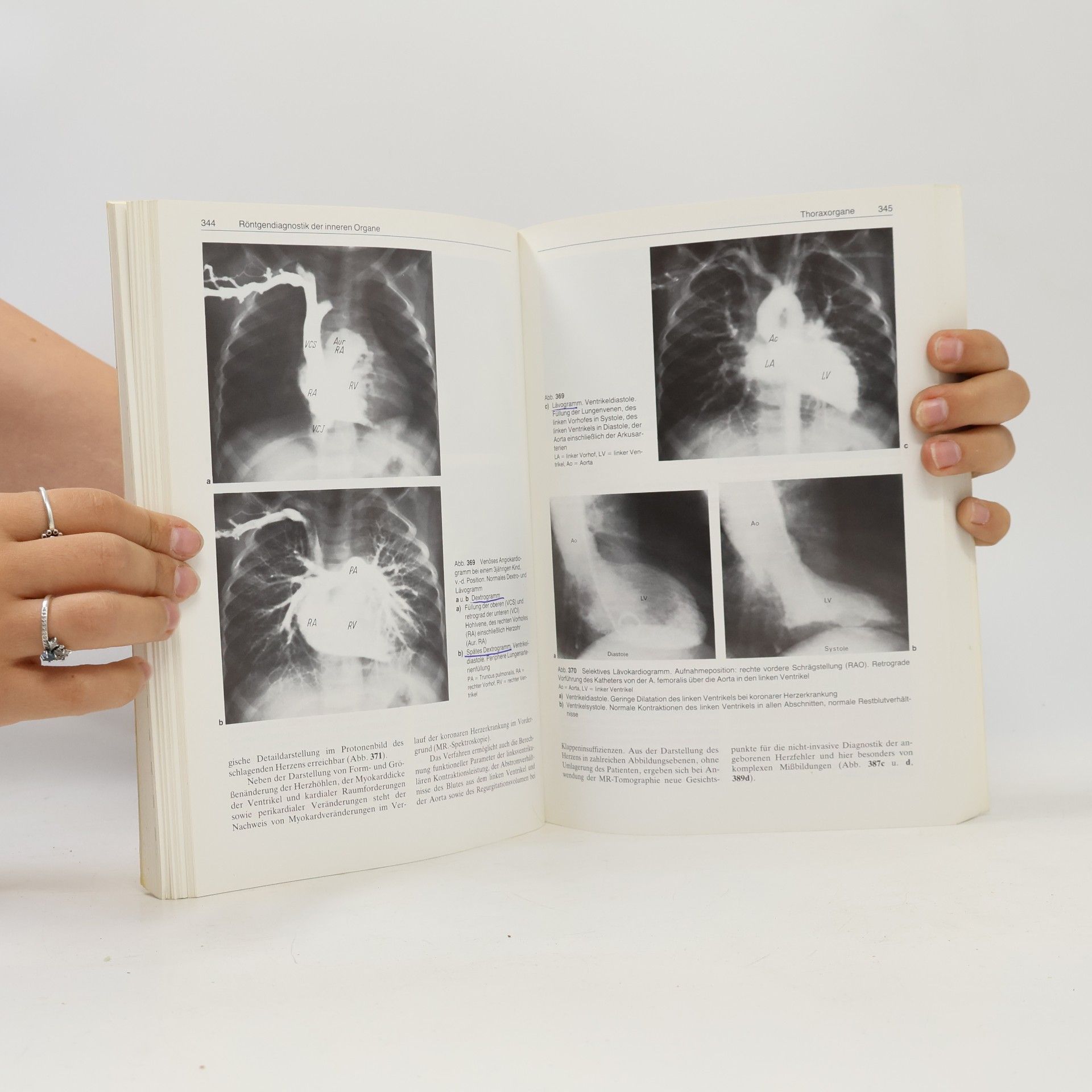 Peter Thurn Einführung in die radiologische Diagnostik