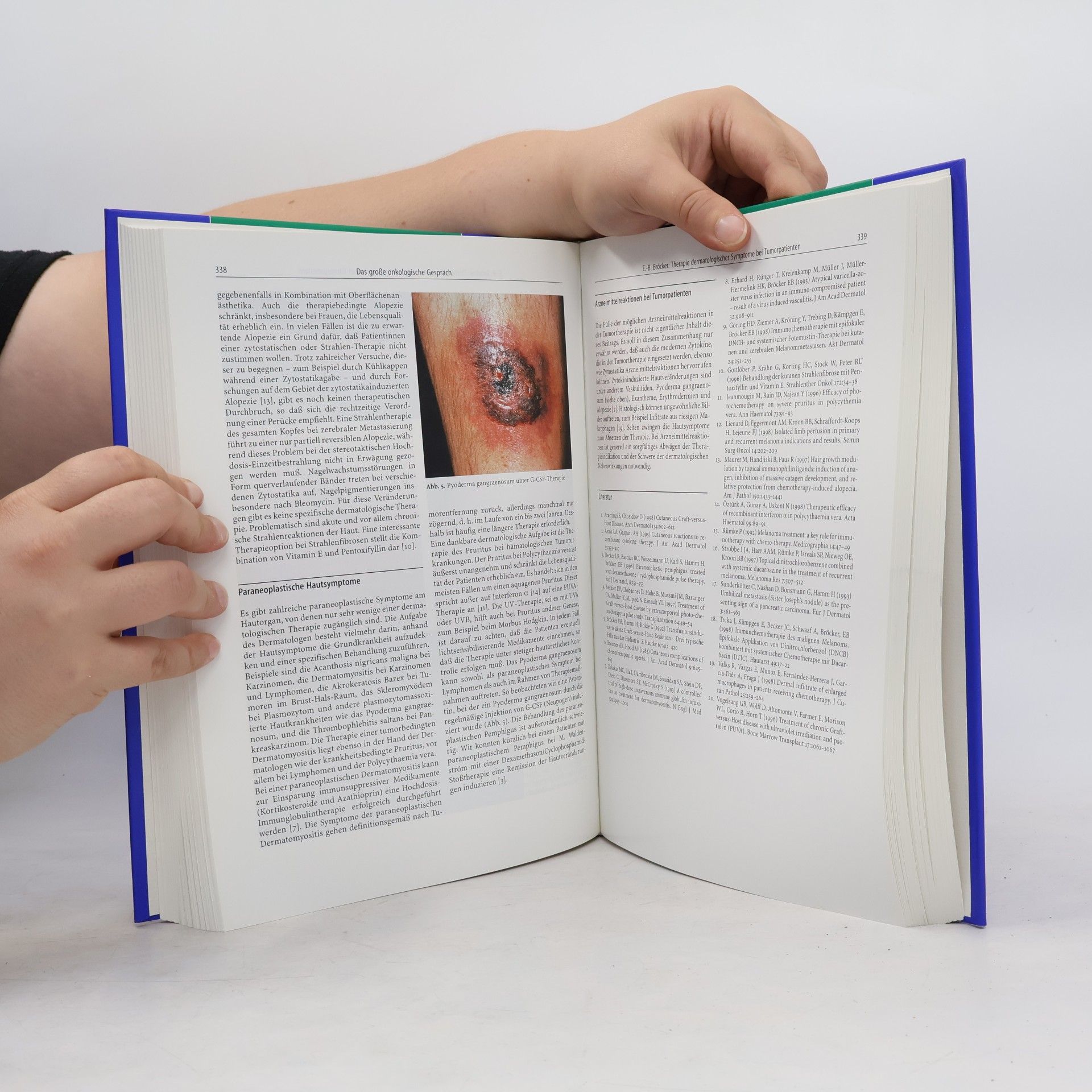 Gerd Plewig Fortschritte der praktischen Dermatologie und Venerologie