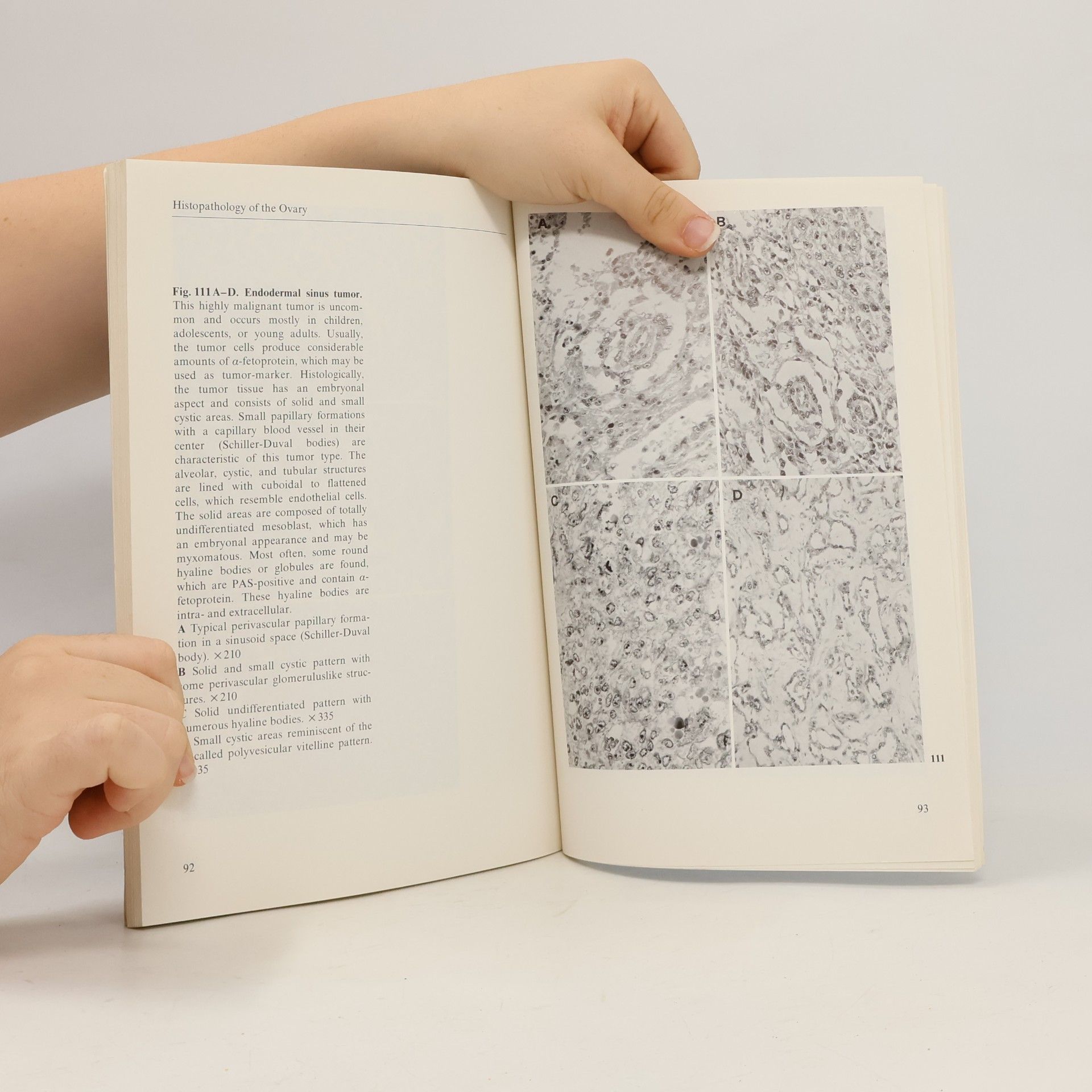 C.Y. Genton Histopathology of the Female Genital Tract