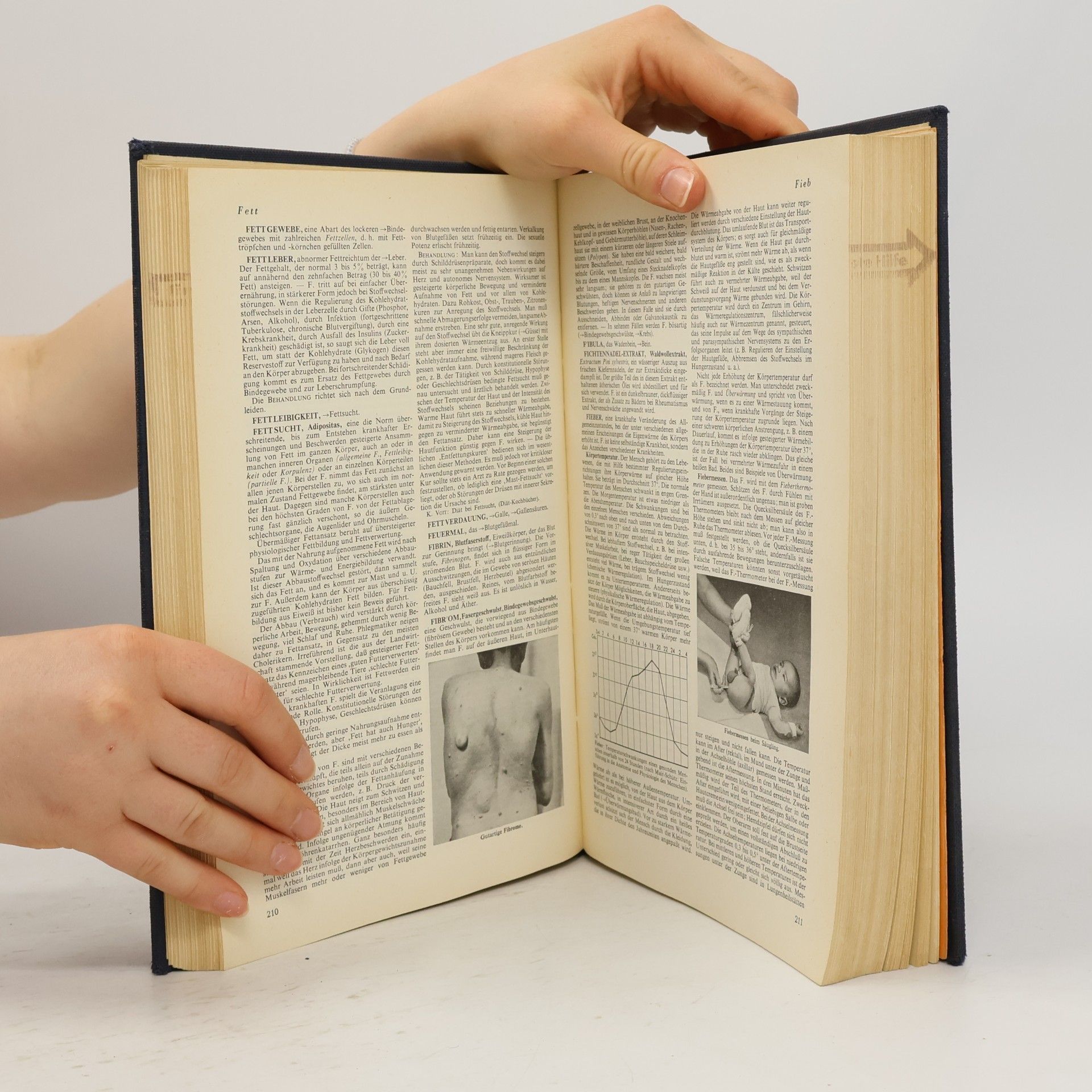 Autorenkollektiv Der Gesundheits Brockhaus