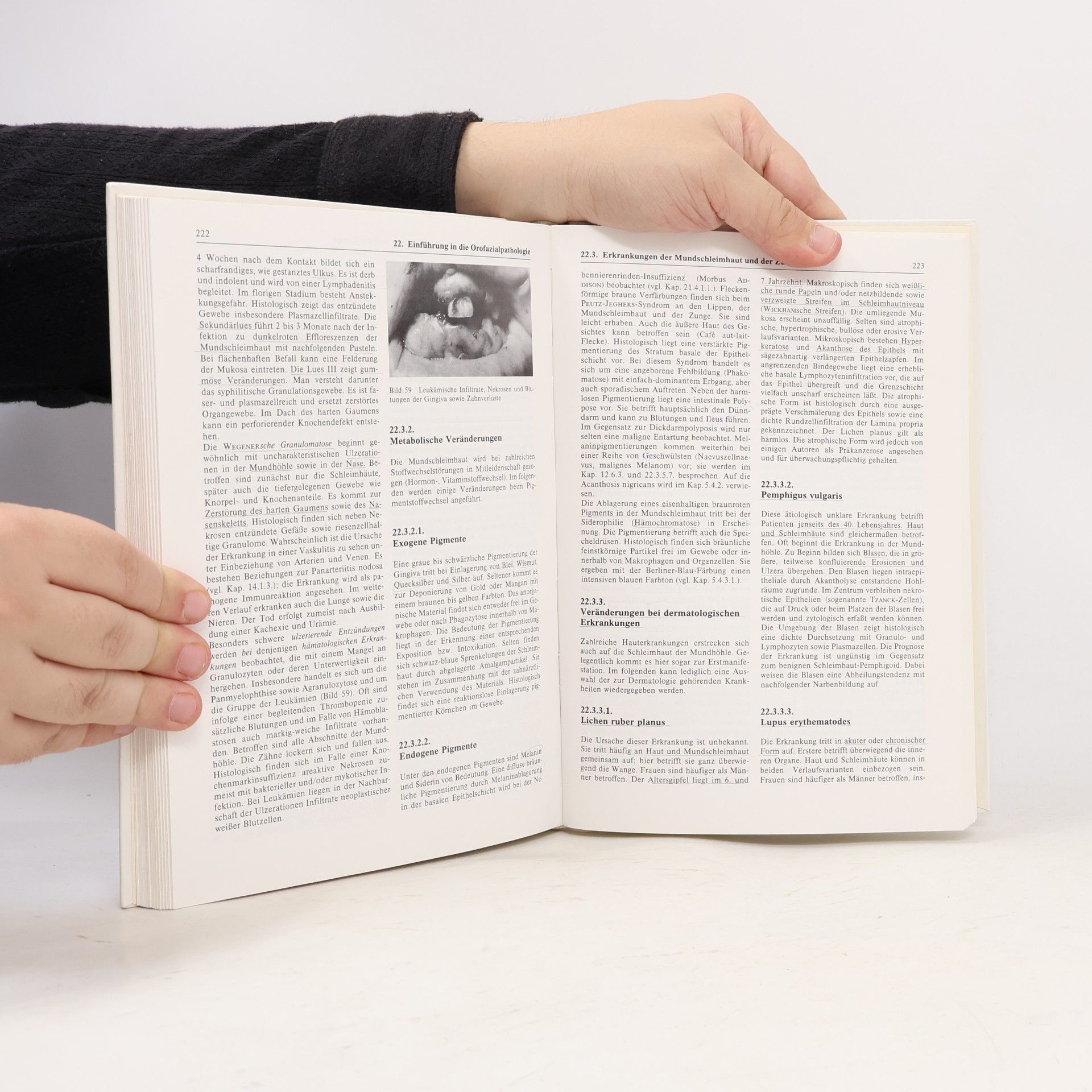 Johann Balthasar Wohlgemuth Allgemeine und spezielle Pathologie - 2. Auflage