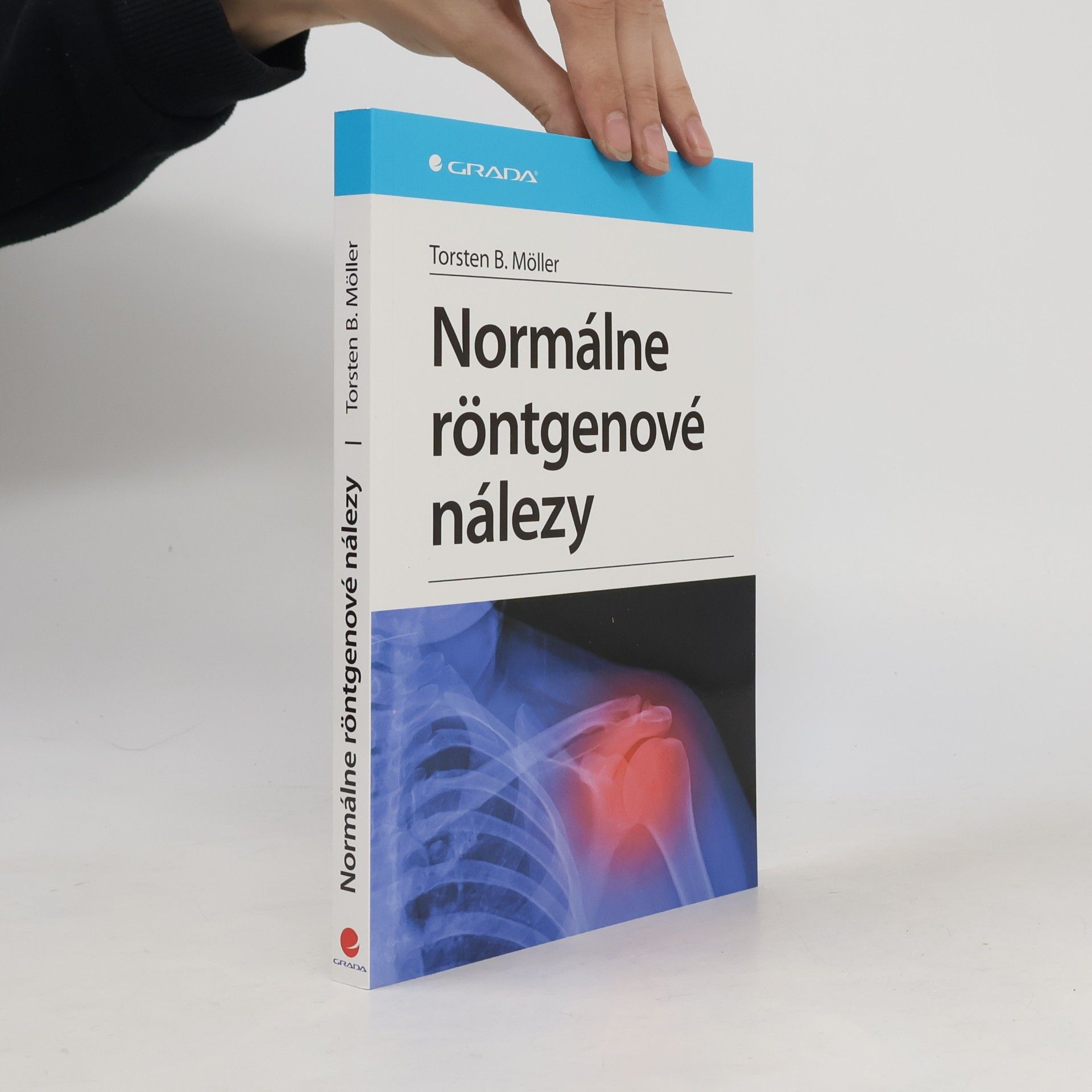 Torsten B. Möller Normálne röntgenové nálezy