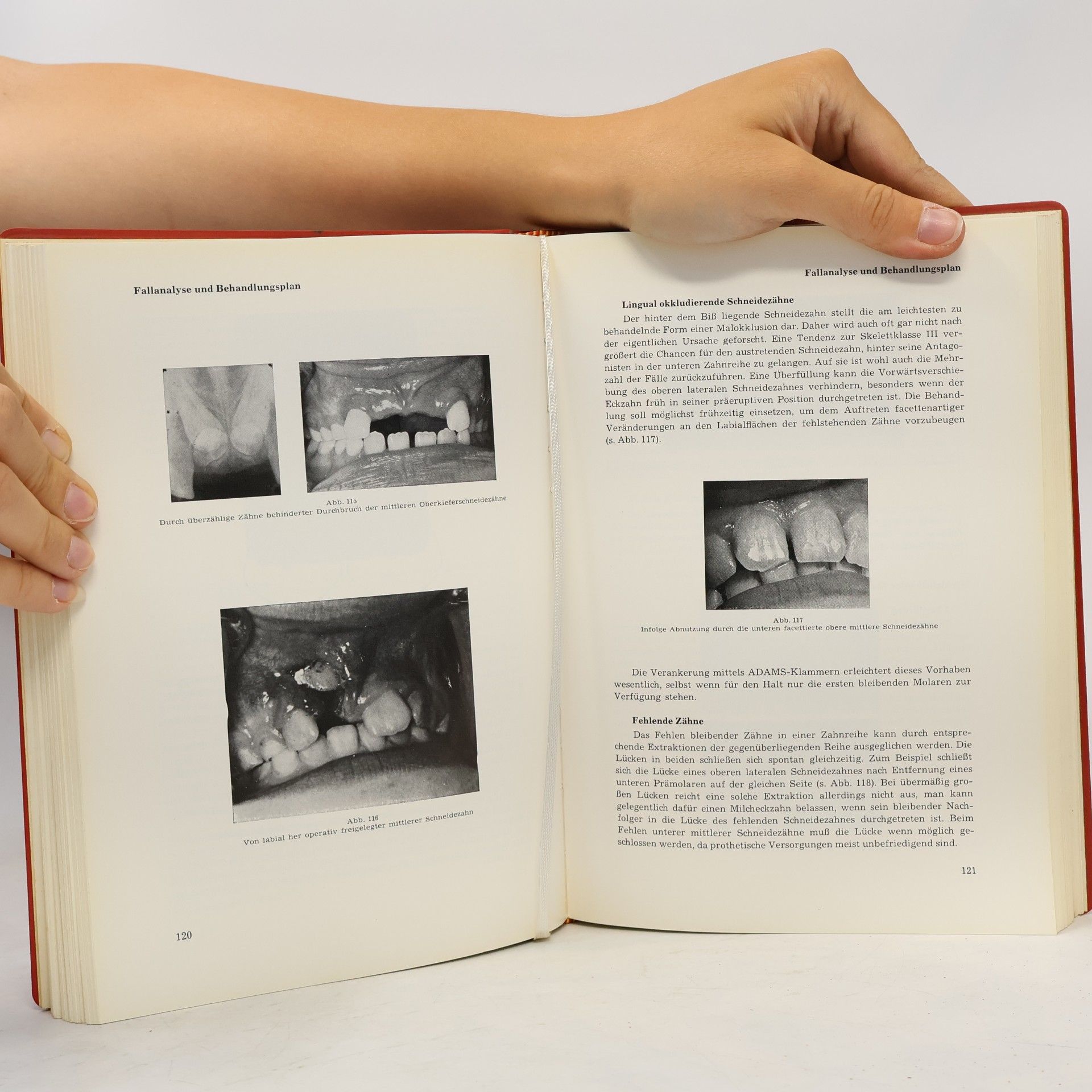 Gordon C. Dickson Kurzlehrbuch der Kieferorthopädie