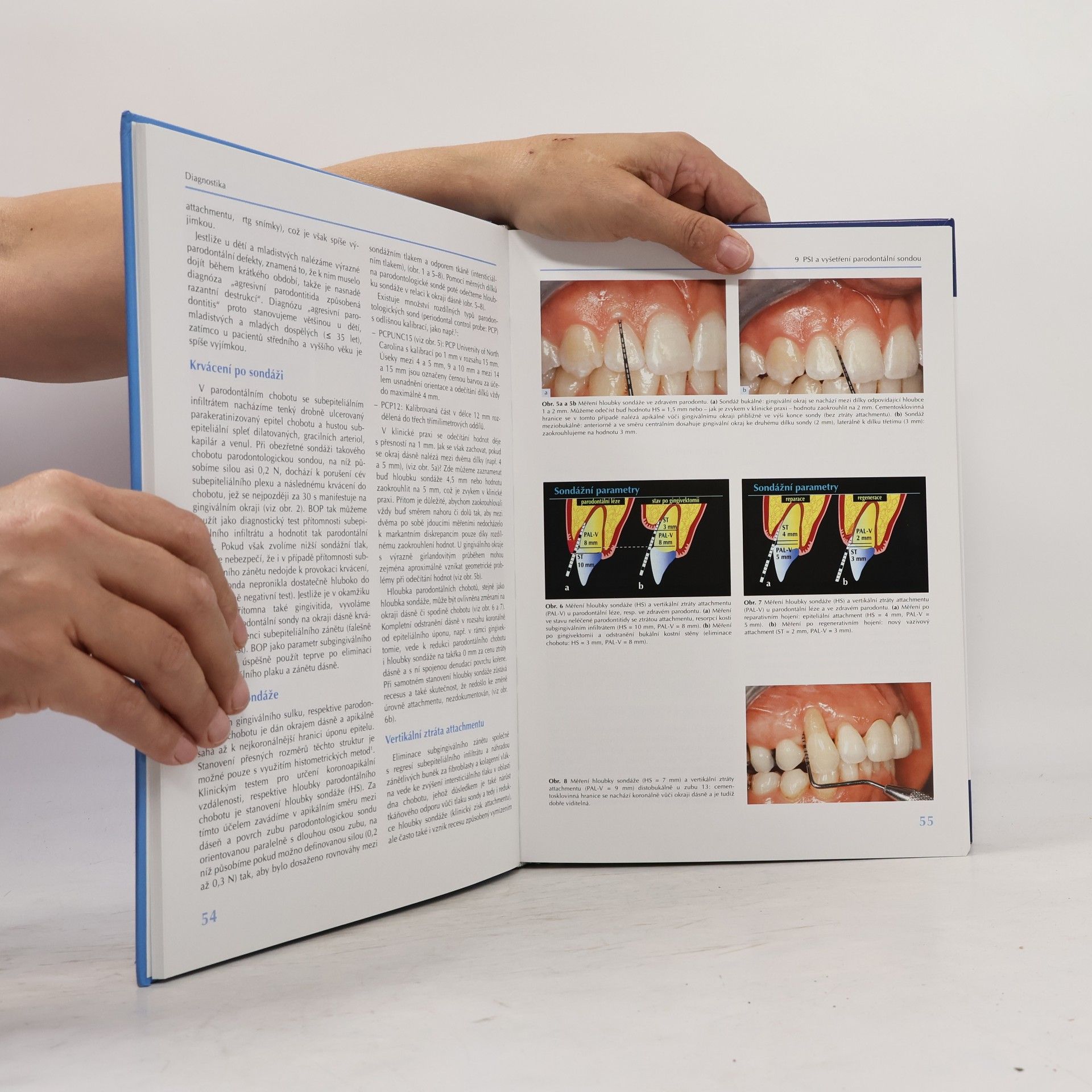 Peter Eickholz Parodontologie od A do Z
