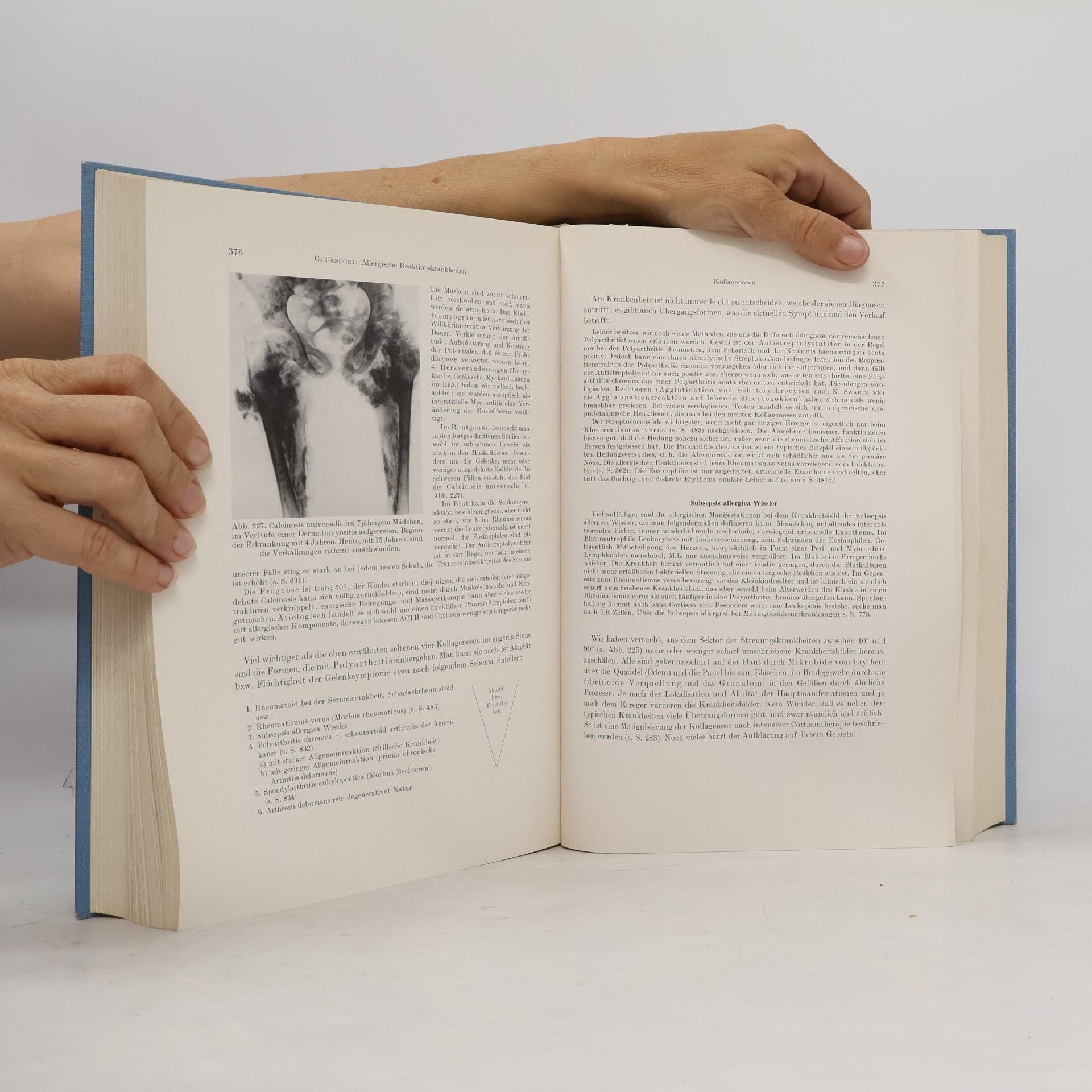 G. Fanconi Lehrbuch der Pädiatrie