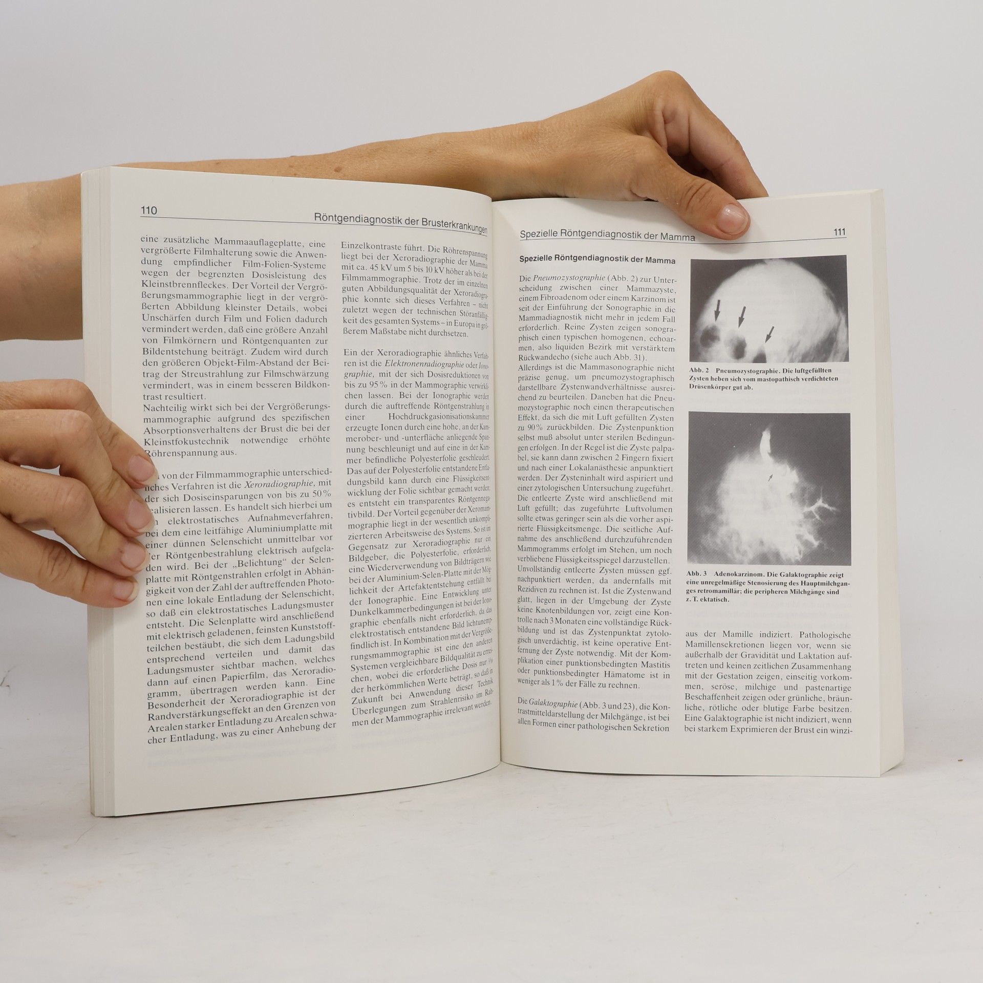 Friedrich Wilhelm Schildberg Interdisziplinäre Therapie des Mammakarzinoms