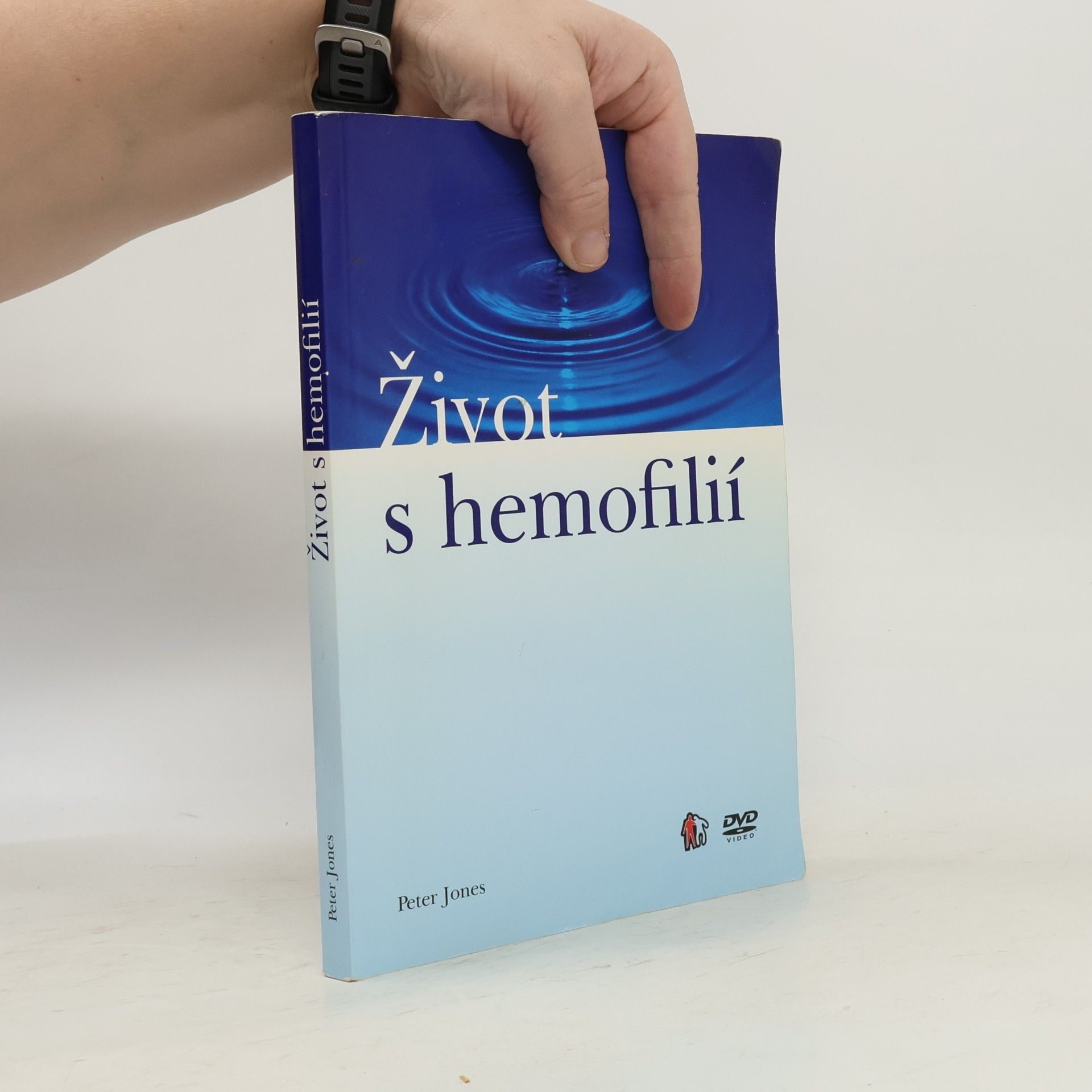 Peter Jones Život s hemofilií