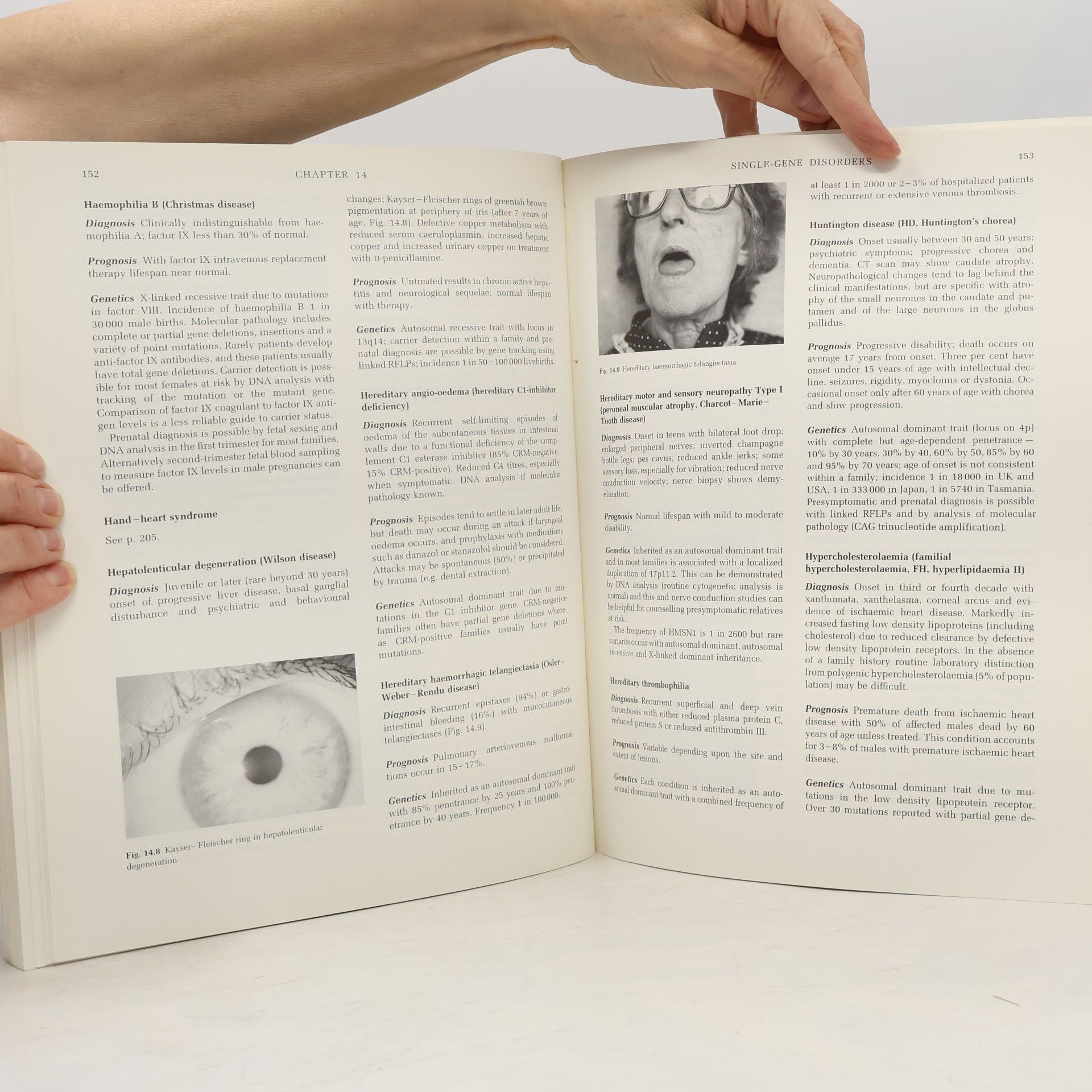 James Michael Connor Essential Series: Essential Medical Genetics