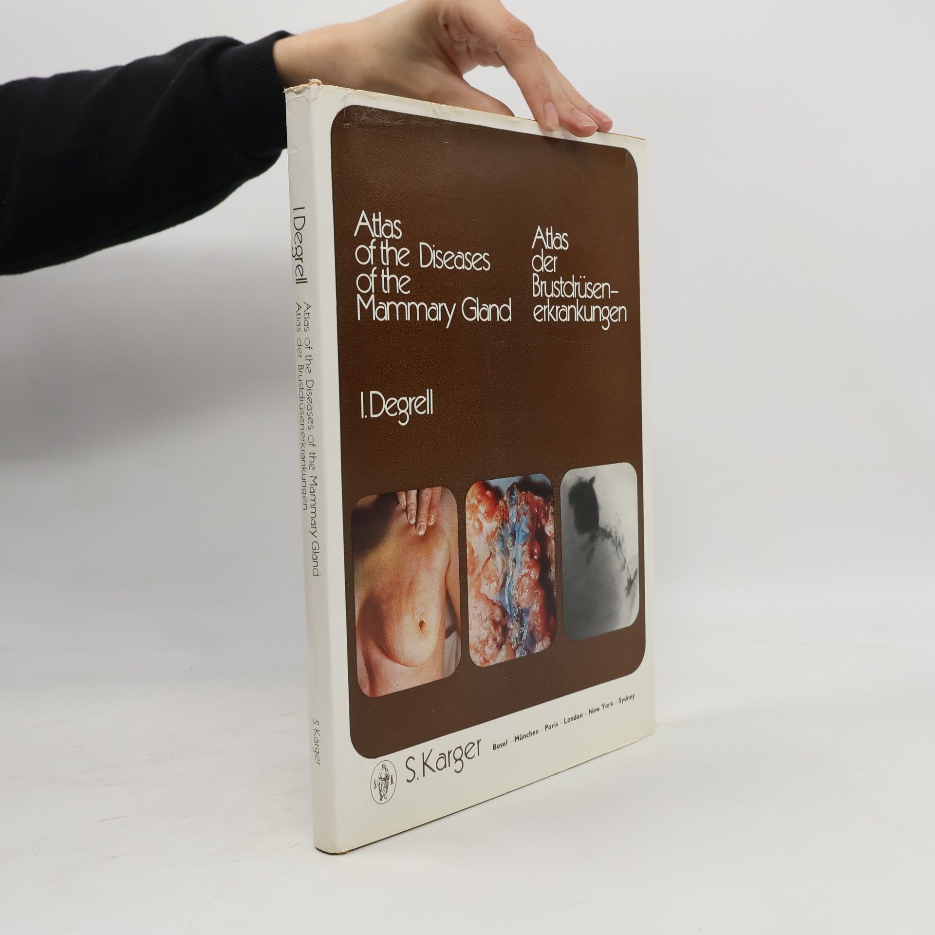 Istvan Degrell Atlas of the Diseases of the Mammary Gland