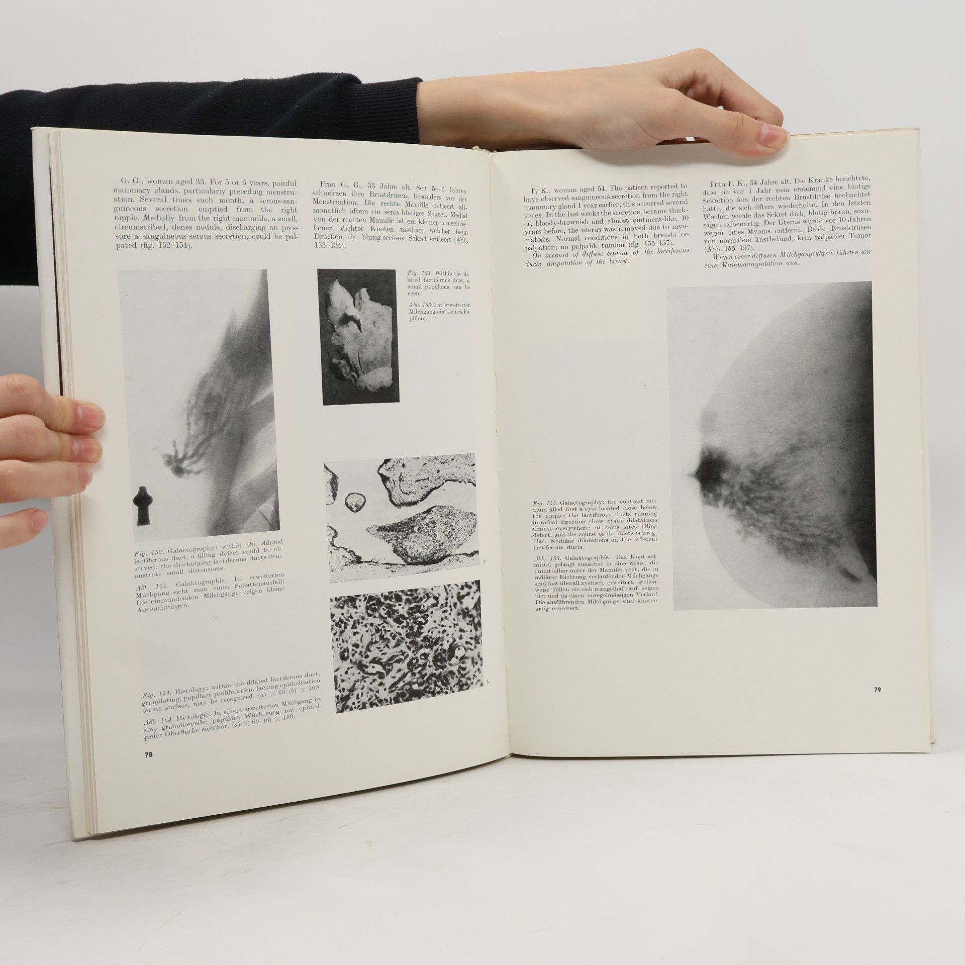 Istvan Degrell Atlas of the Diseases of the Mammary Gland