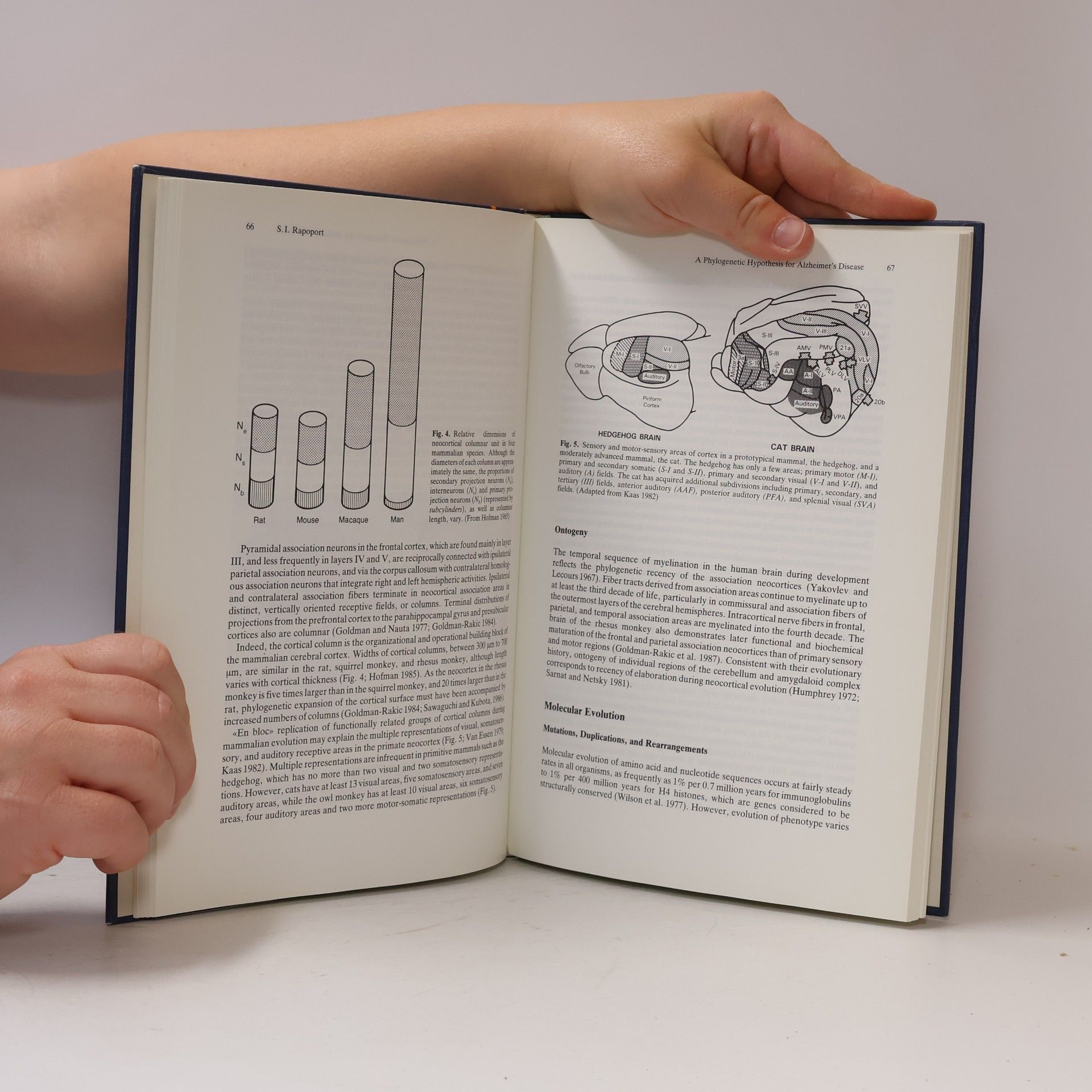 Pierre M. Sinet Genetics and Alzheimer's Disease