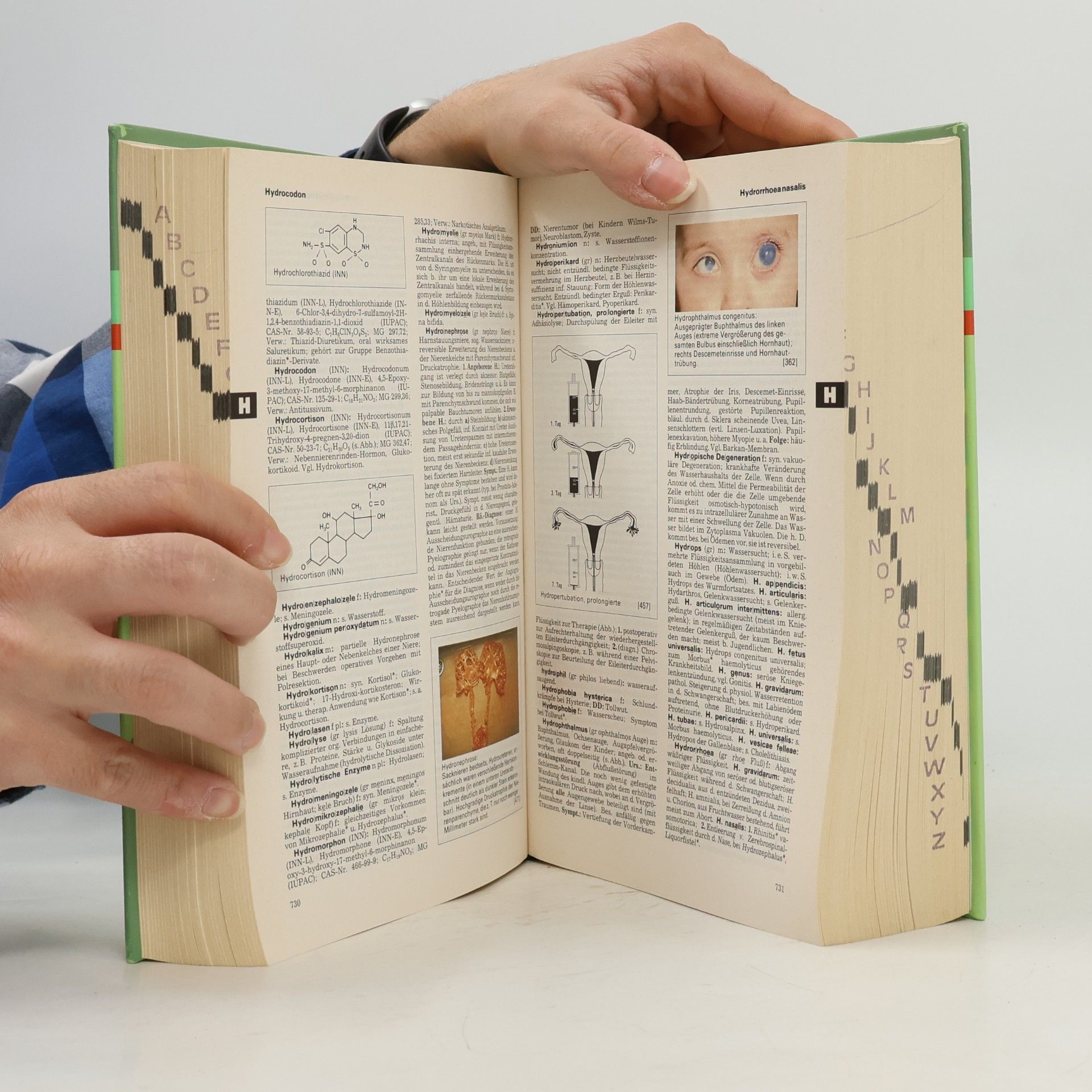 Helmut Hildebrandt Pschyrembel Klinisches Wörterbuch