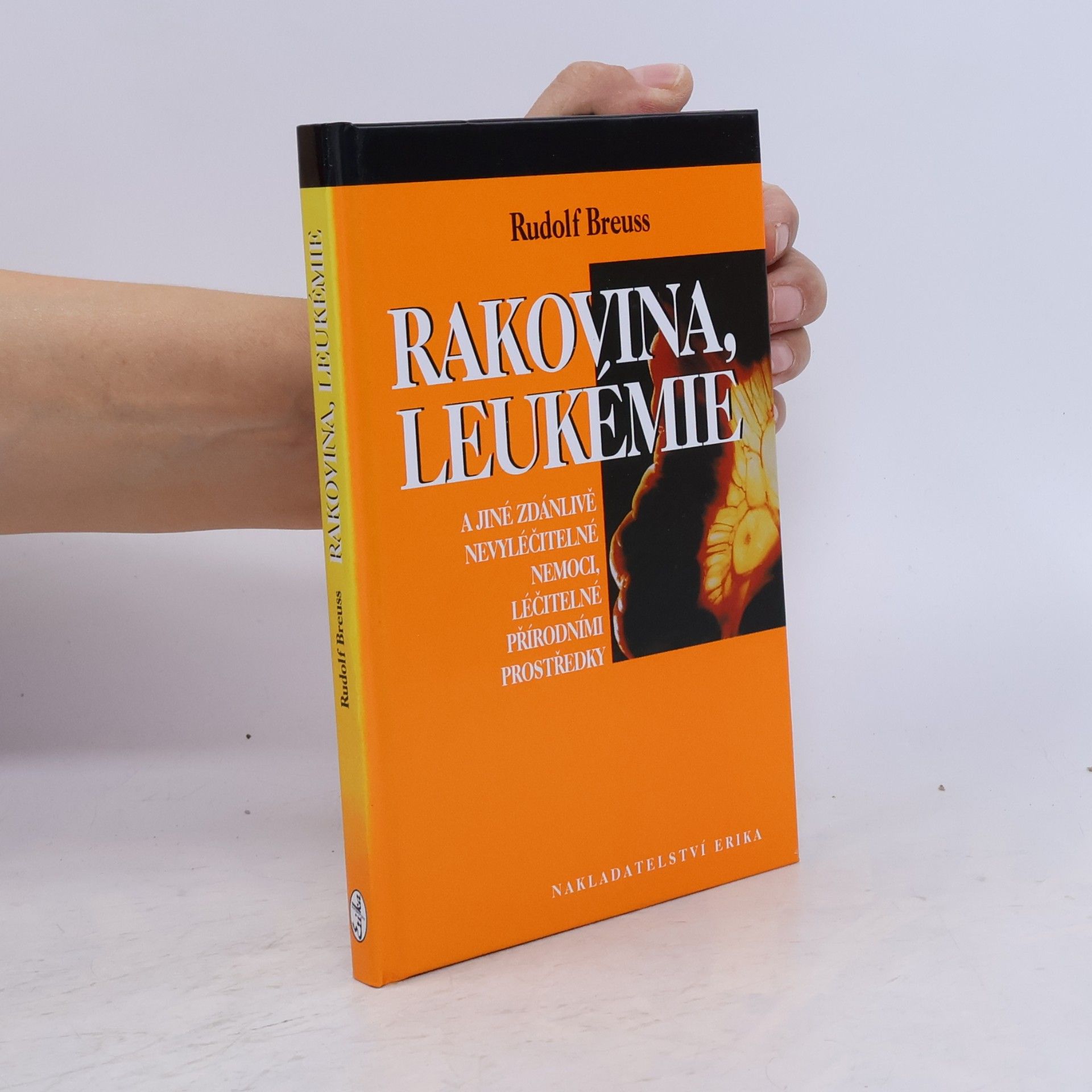 Rudolf Breuss Rakovina, leukémie a jiné zdánlivě nevyléčitelné nemoci, léčitelné přírodními prostředky