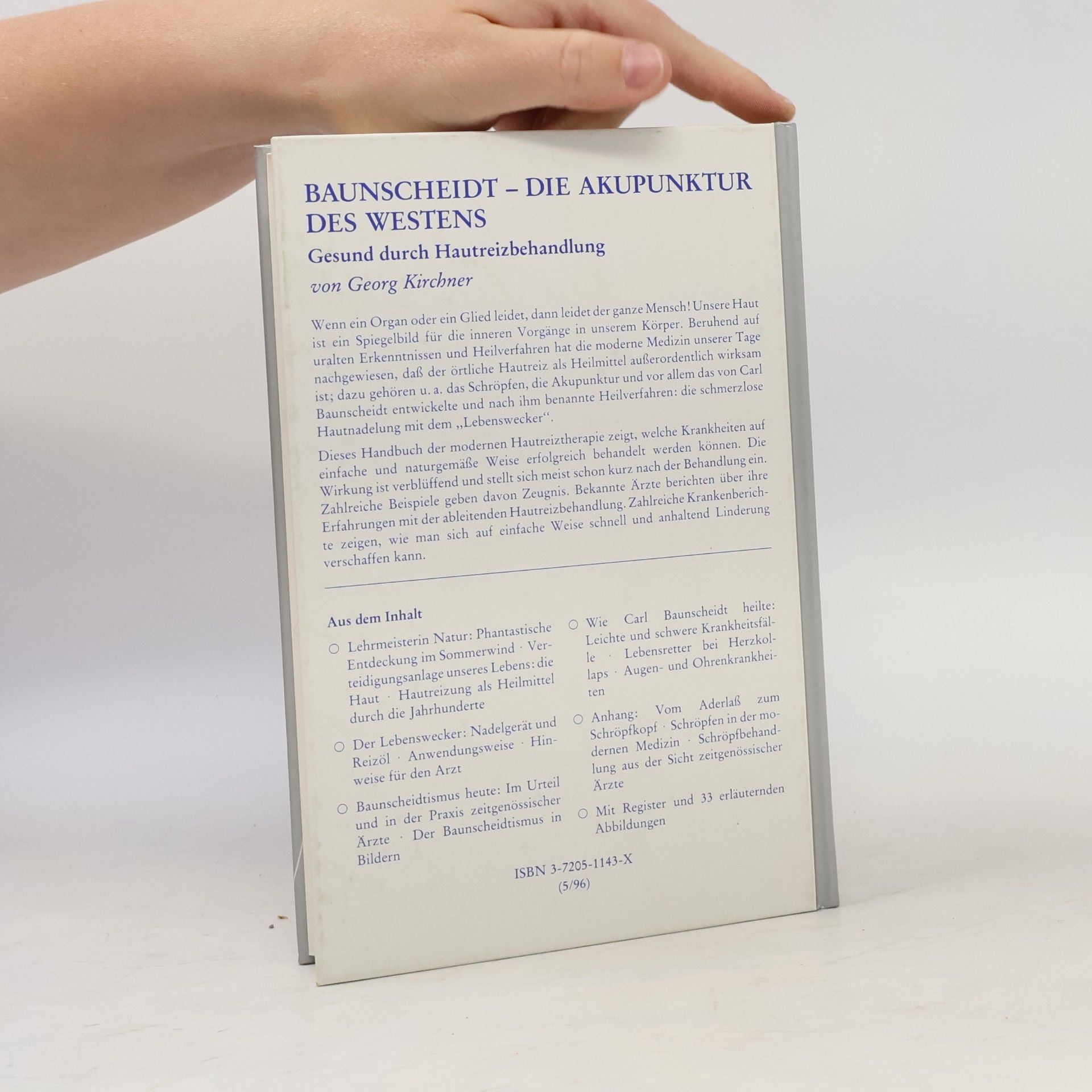 Georg Kirchner Baunscheidt, die Akupunktur des Westens