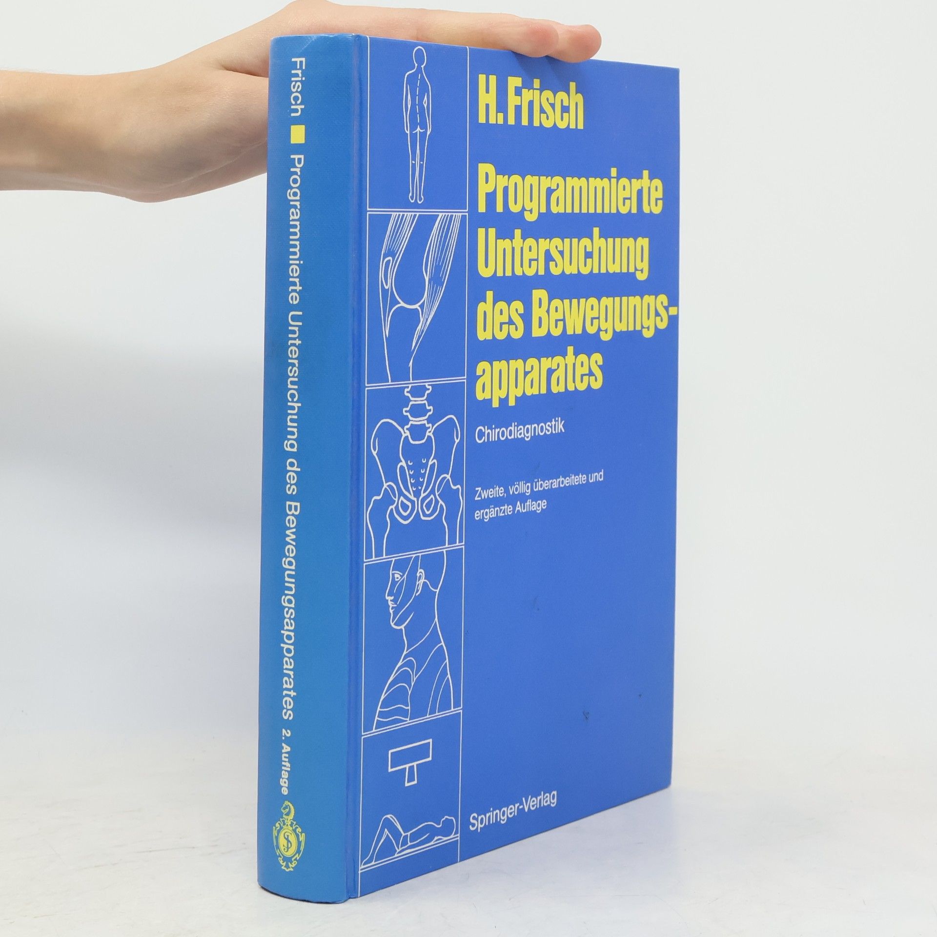 Herbert Frisch Programmierte Untersuchung des Bewegungsapparates: Chirodiagnostik; mit 15 Tabellen - Zweite, völlig überarbeitete und ergänzte Auflage