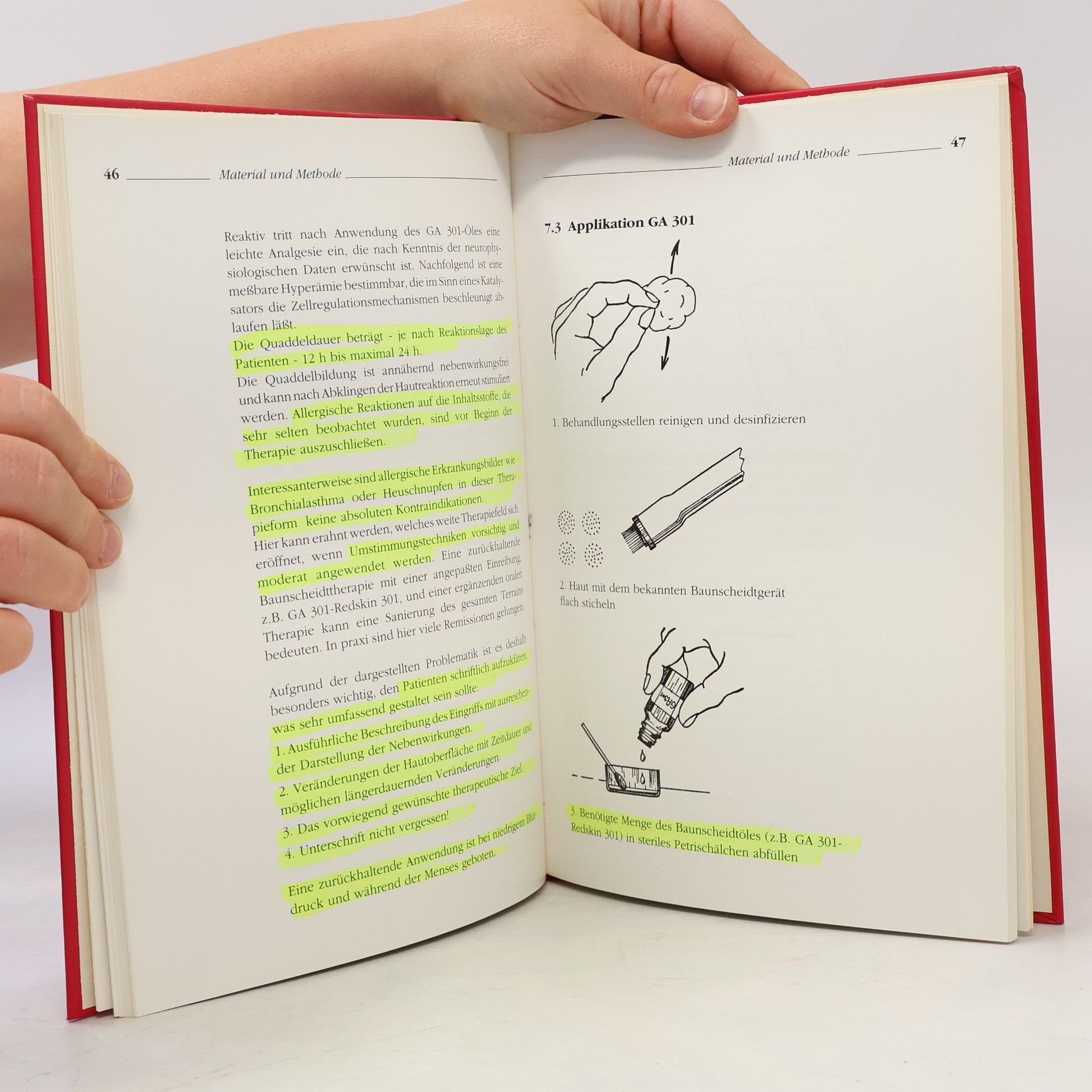 Martin Adler Die Baunscheidtmethode. Handbuch für die tägliche Praxis