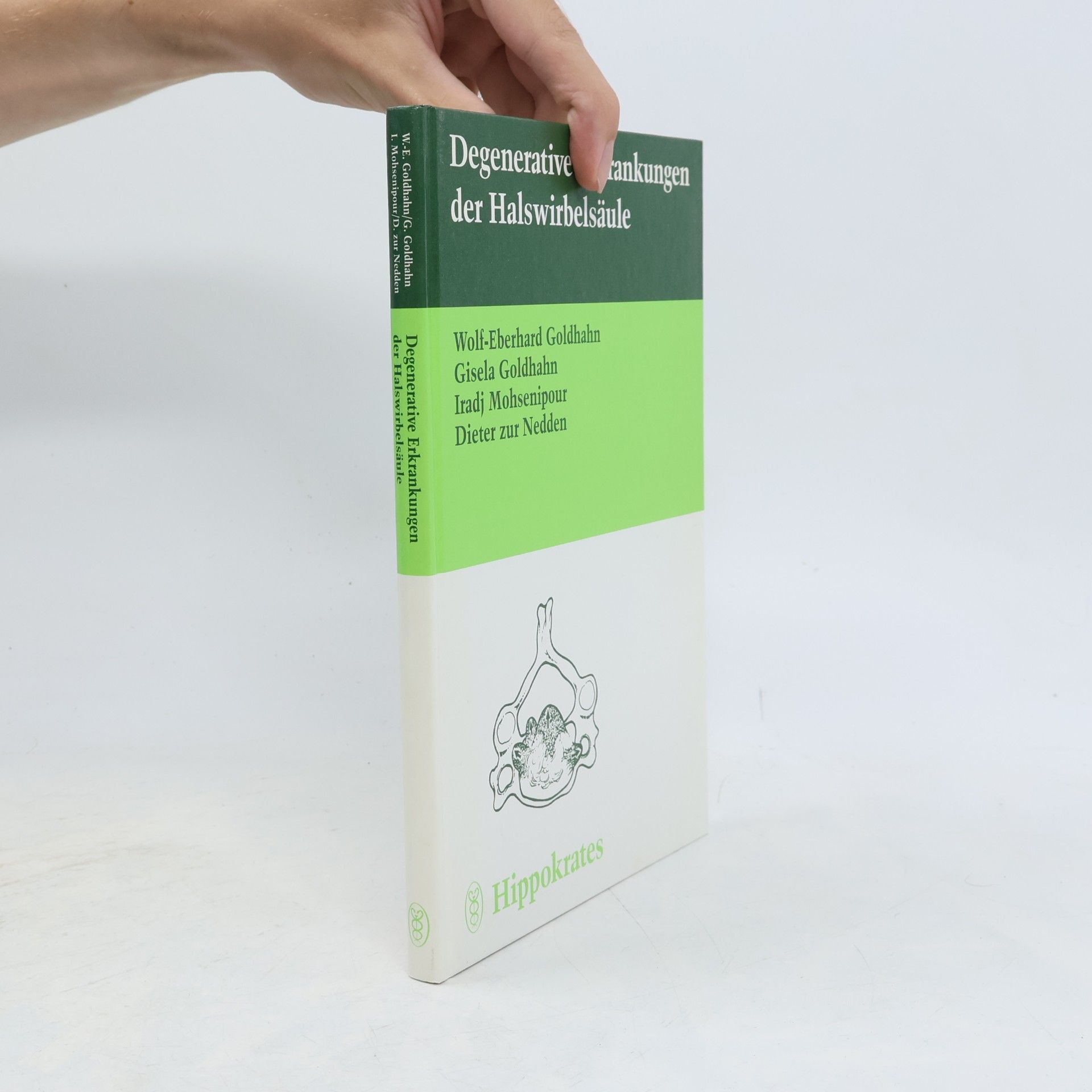 Dieter zur Nedden Degenerative Erkrankungen der Halswirbelsäule