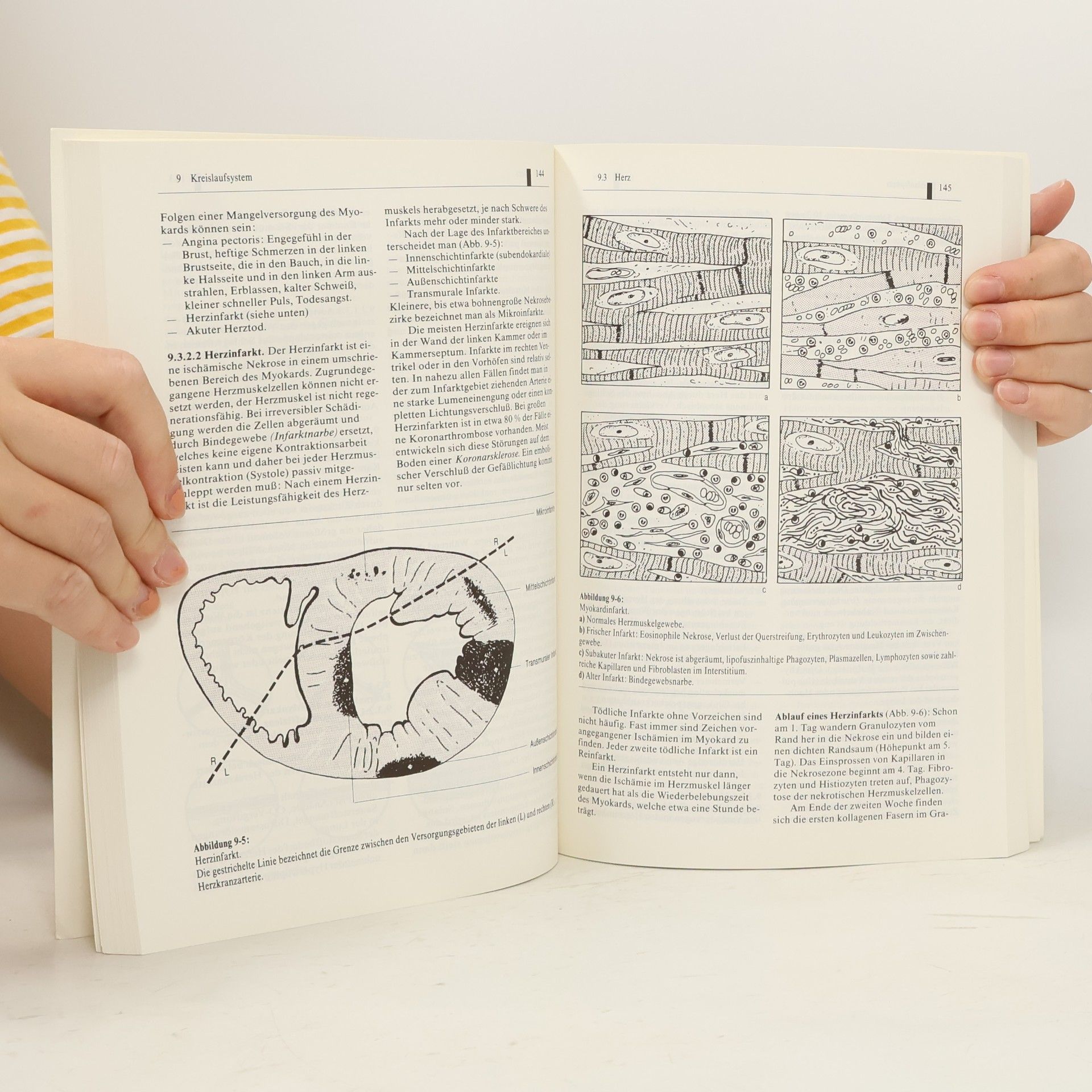 Herbert Hees Allgemeine und spezielle Pathologie