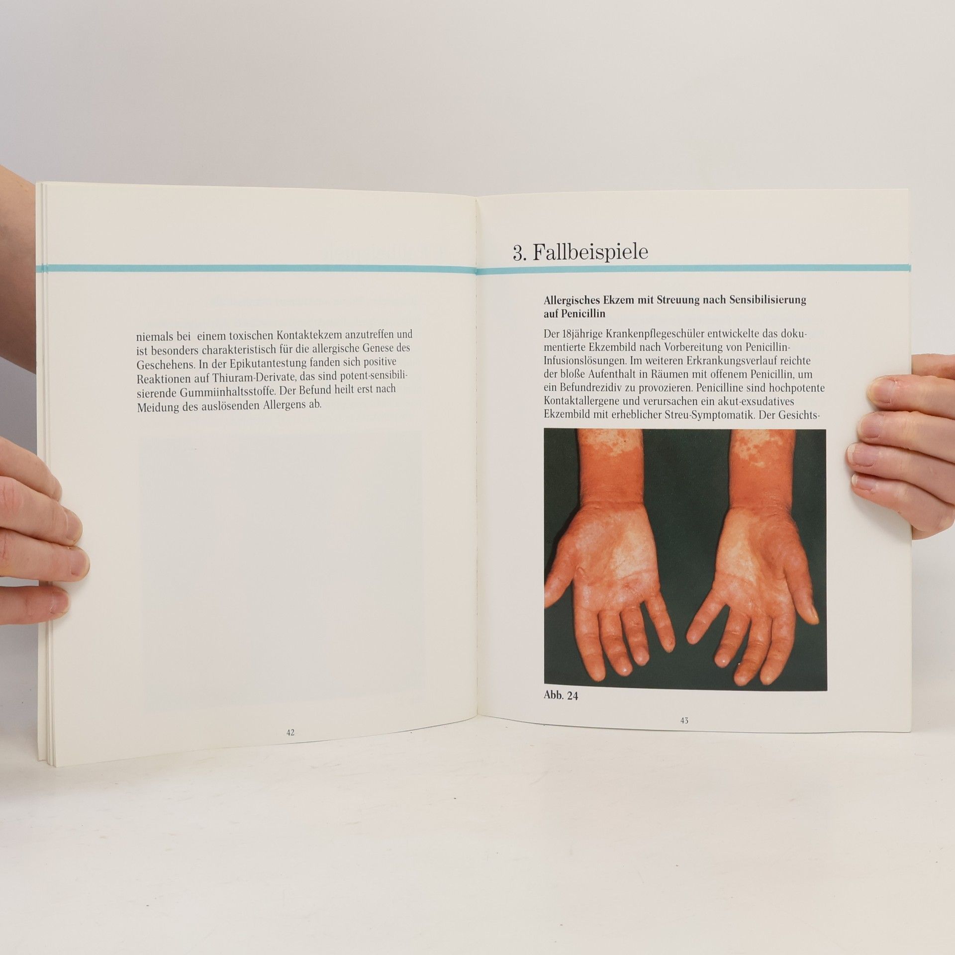 Autorenkollektiv Berufsdermatosen