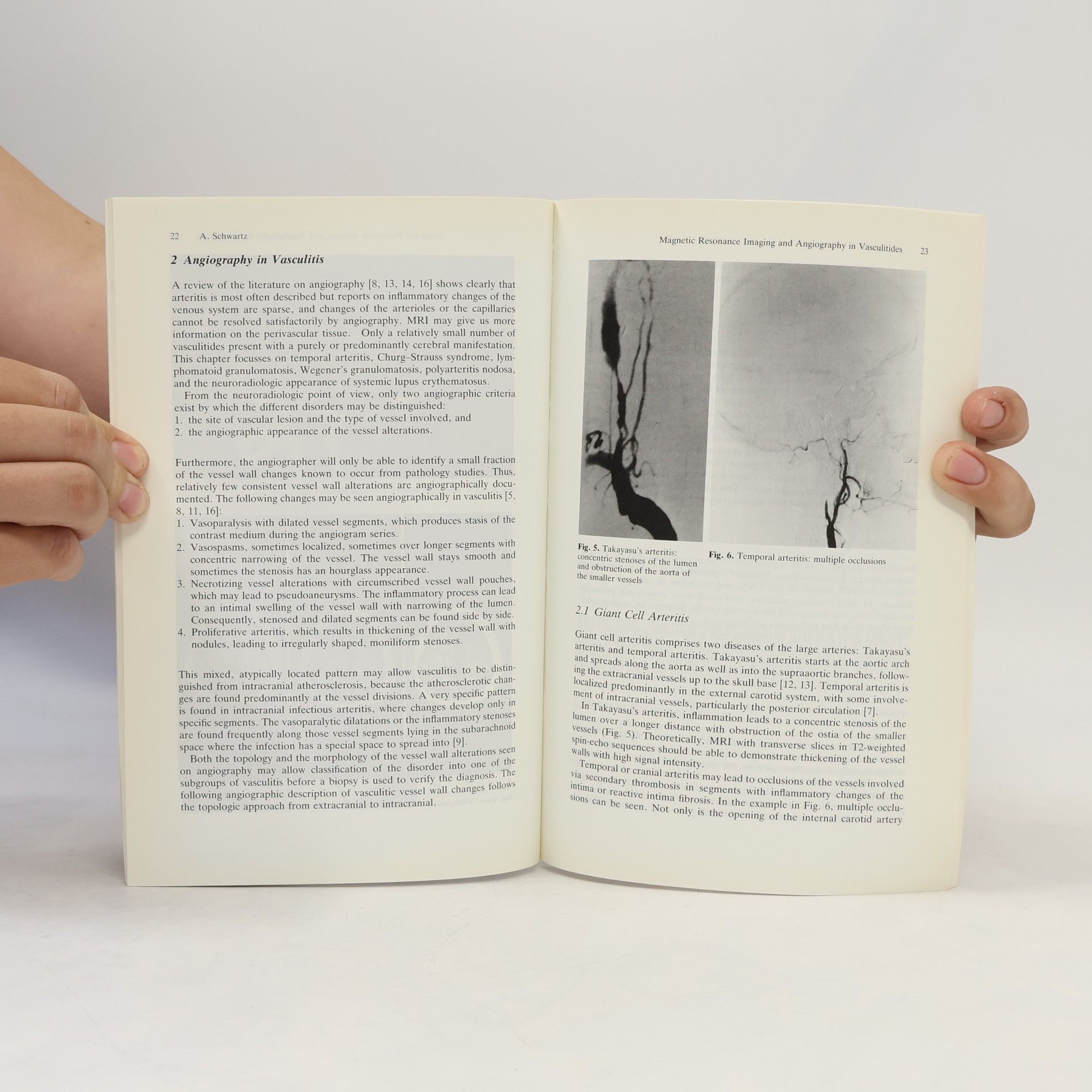 Peter Berlit Vasculitis, Rheumatic Disease and the Nervous System