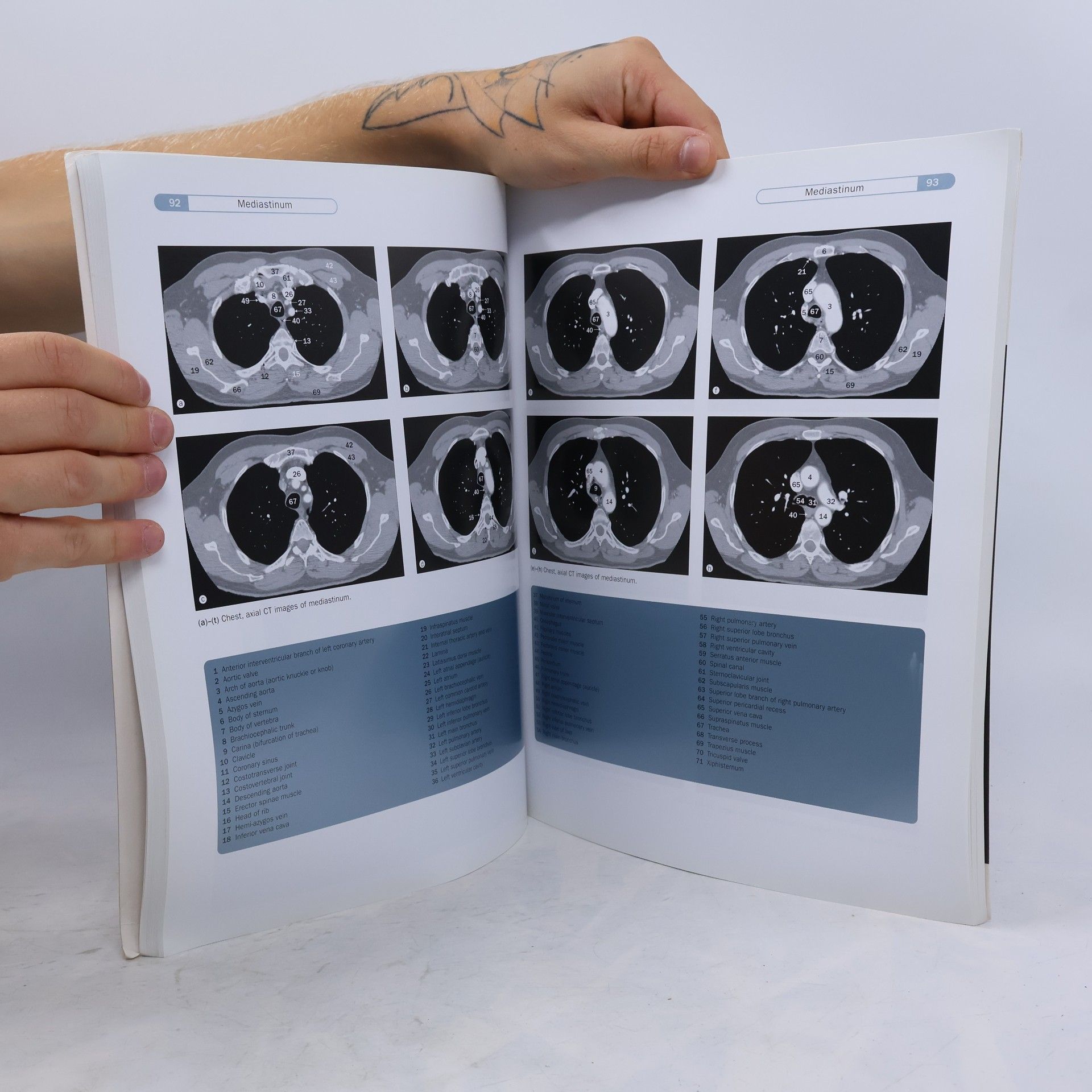 Jonathan D. Spratt Imaging Atlas of Human Anatomy