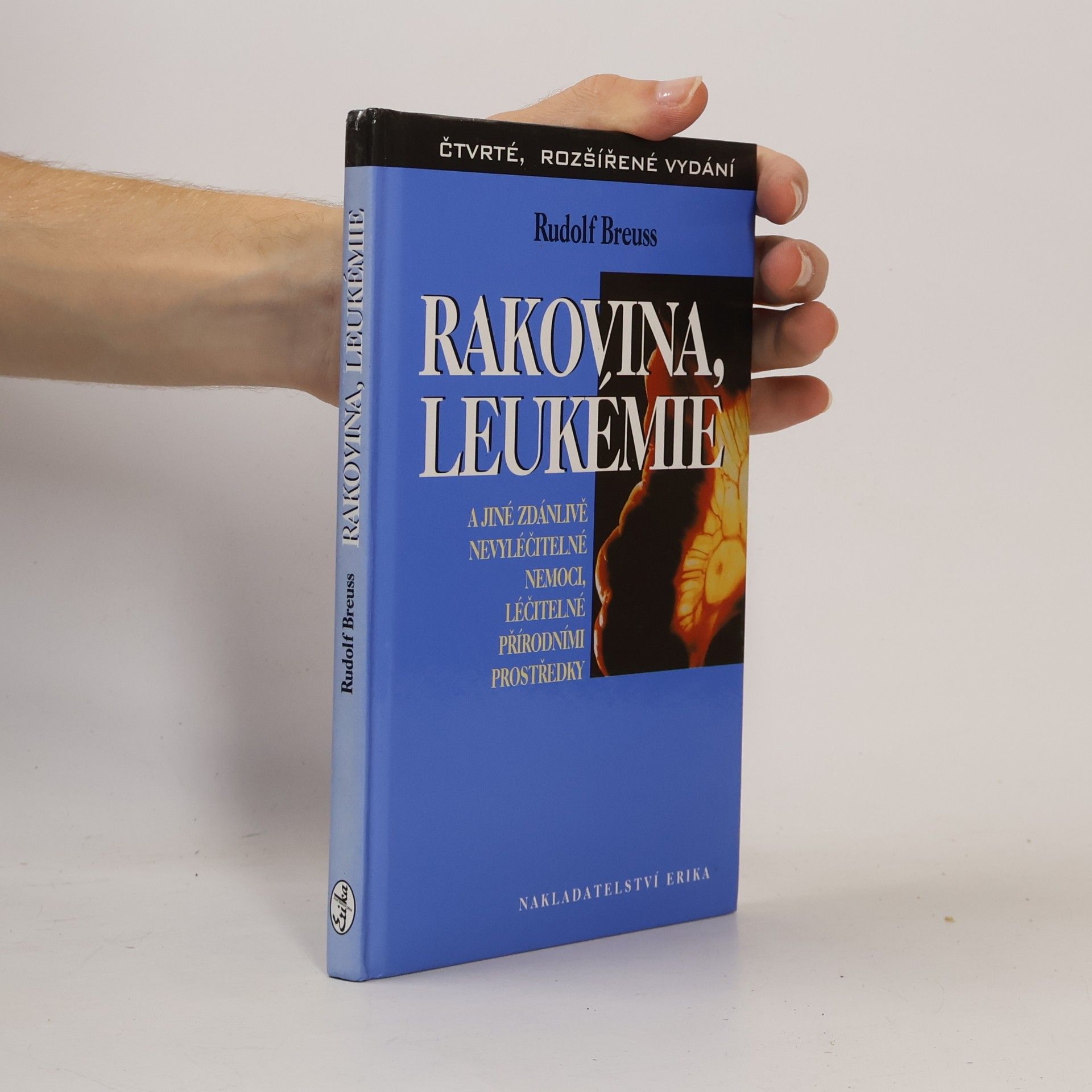 Rudolf Breuss Rakovina, leukémie a jiné zdánlivě nevyléčitelné nemoci, léčitelné přírodními prostředky