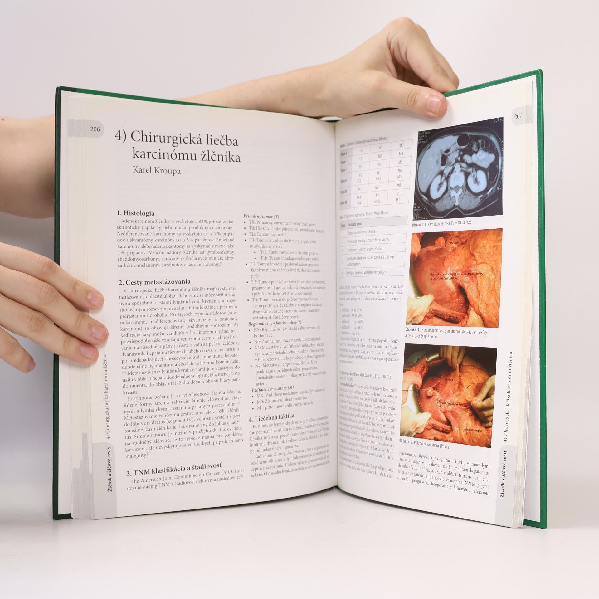 Collectif d'auteurs Gastrointestinálna onkológia