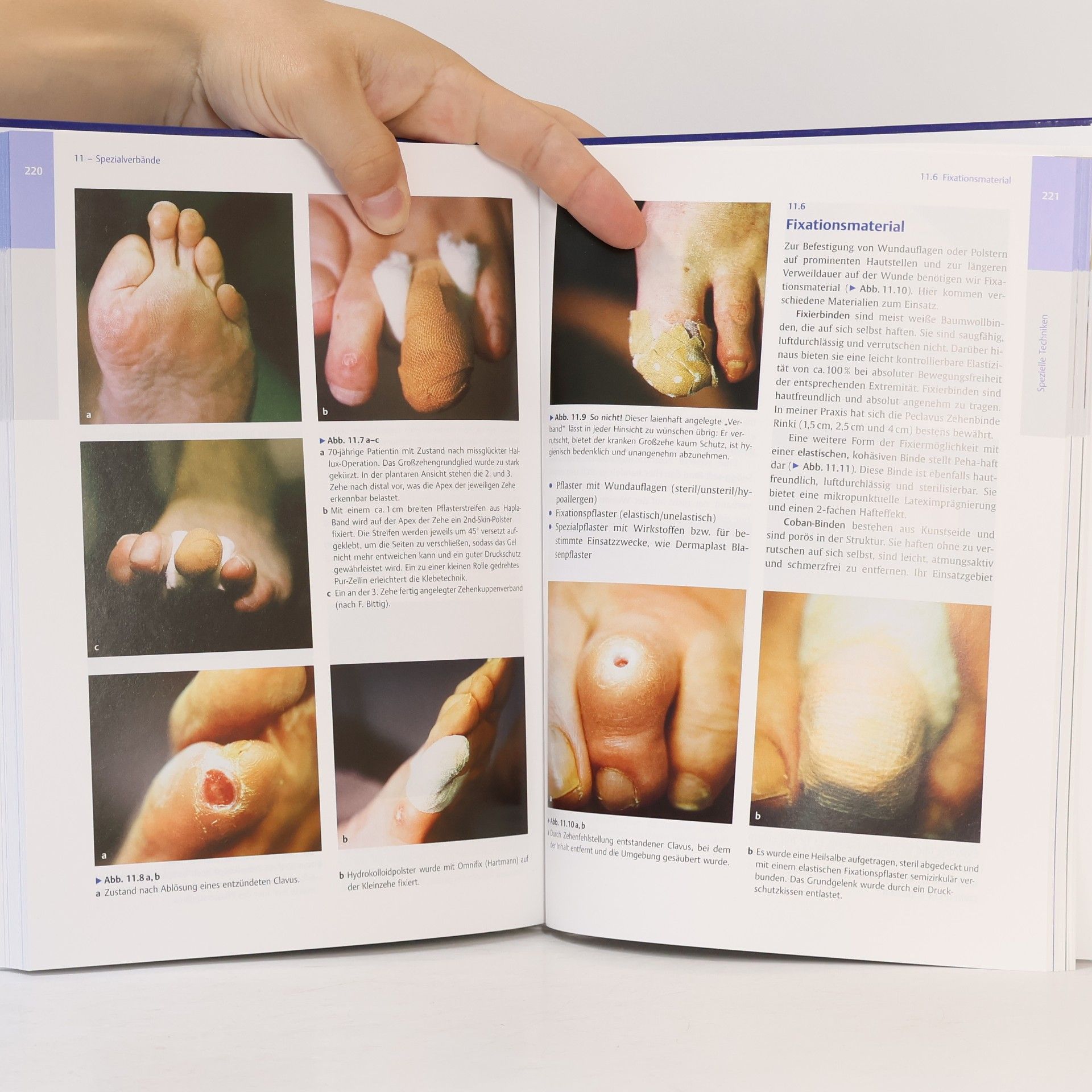Hellmut Ruck Handbuch für die medizinische Fußpflege