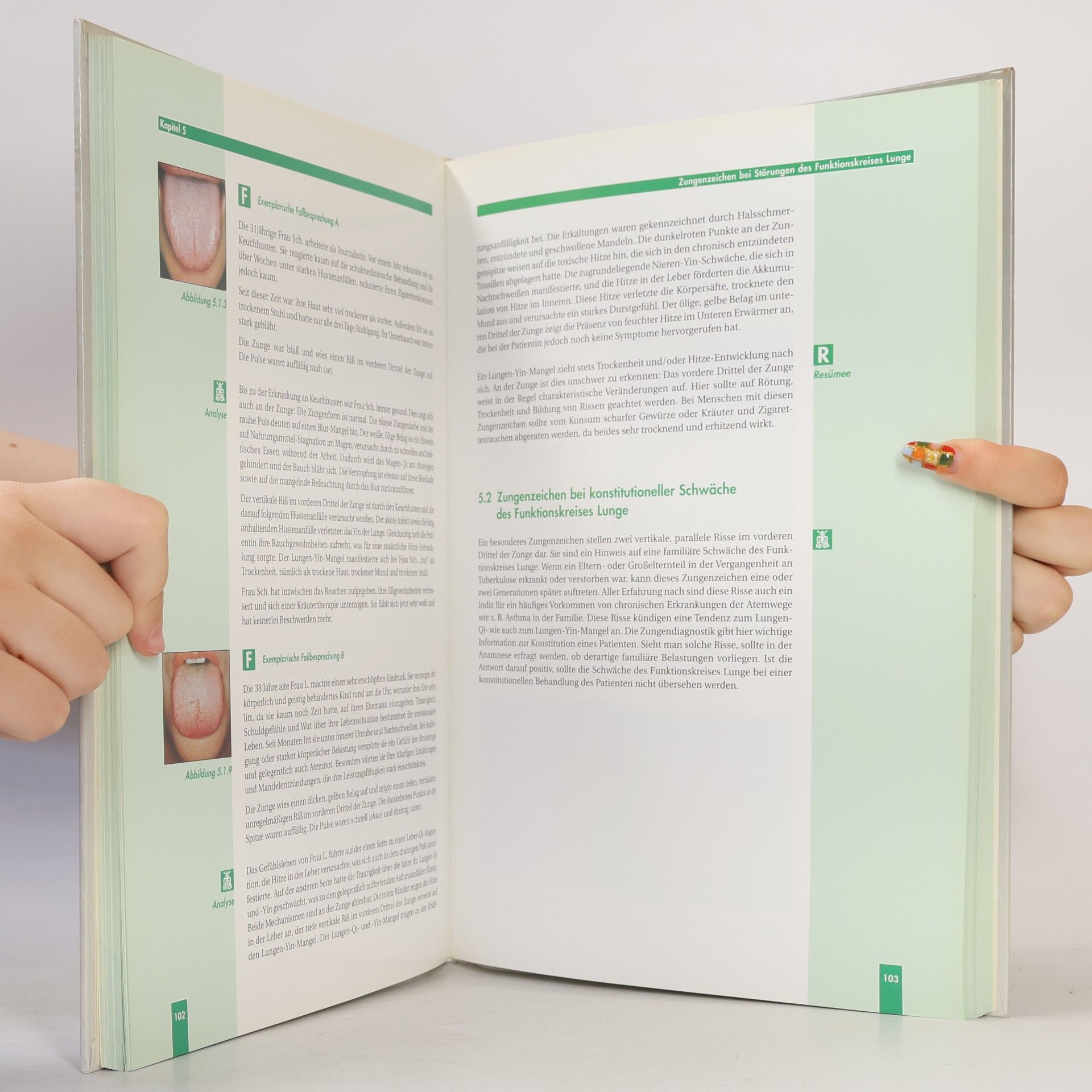 Barbara Kirschbaum Atlas und Lehrbuch der chinesischen Zungendiagnostik