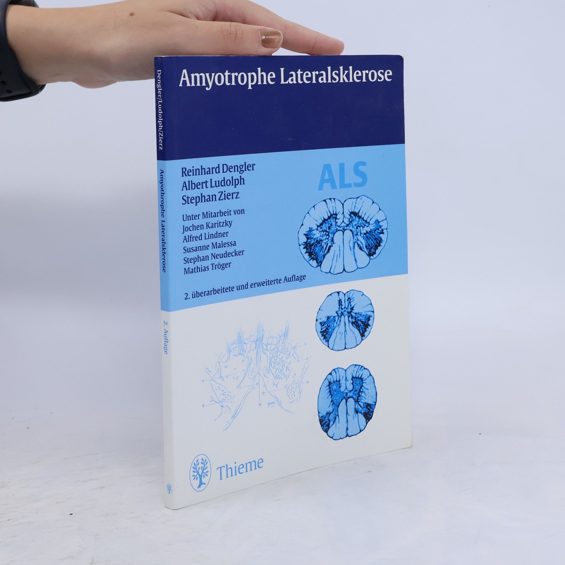 Amyotrophe Lateralsklerose ; 25 Tabellen - 2. überarbeitete und erweiterte Auflage