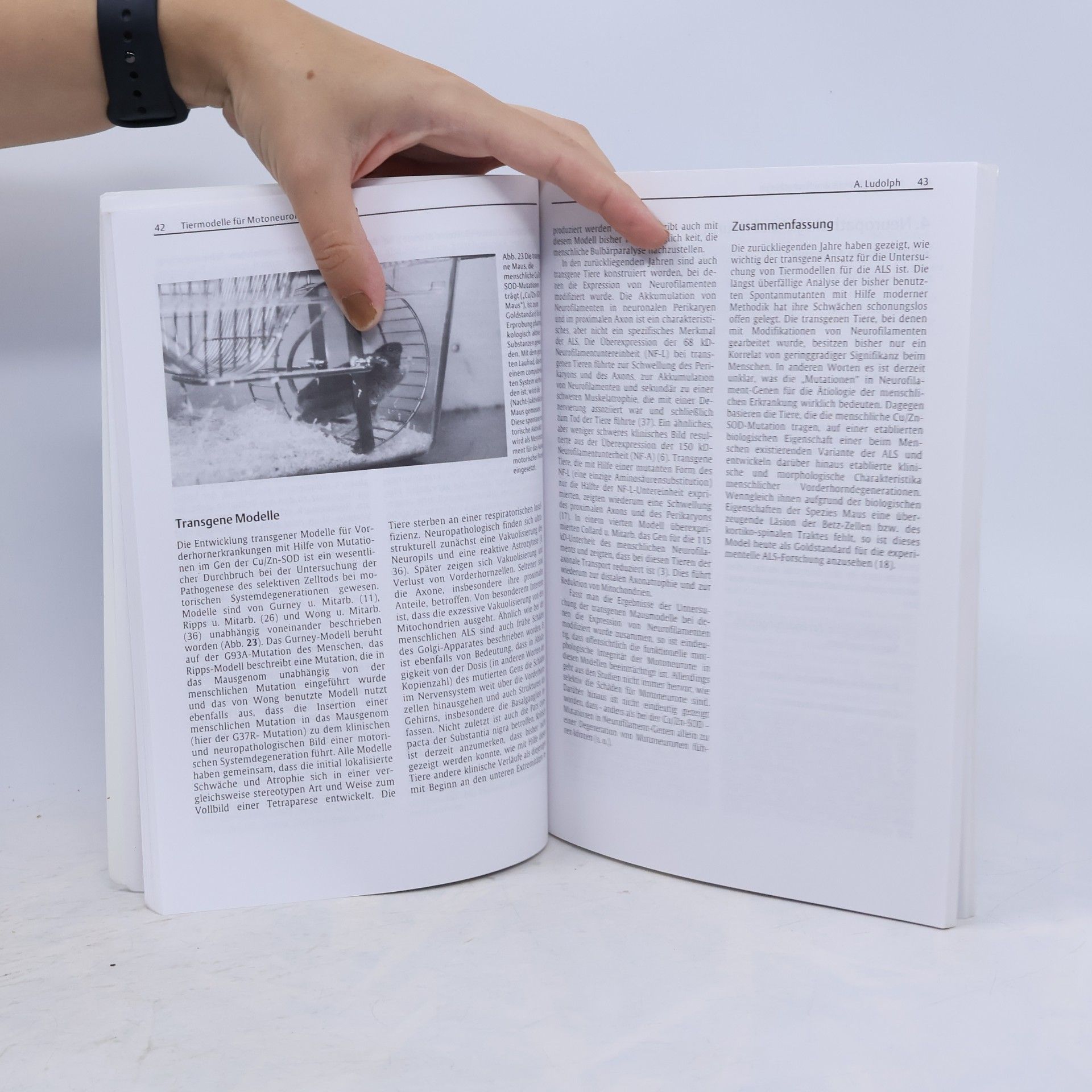 Reinhard Dengler Amyotrophe Lateralsklerose ; 25 Tabellen - 2. überarbeitete und erweiterte Auflage