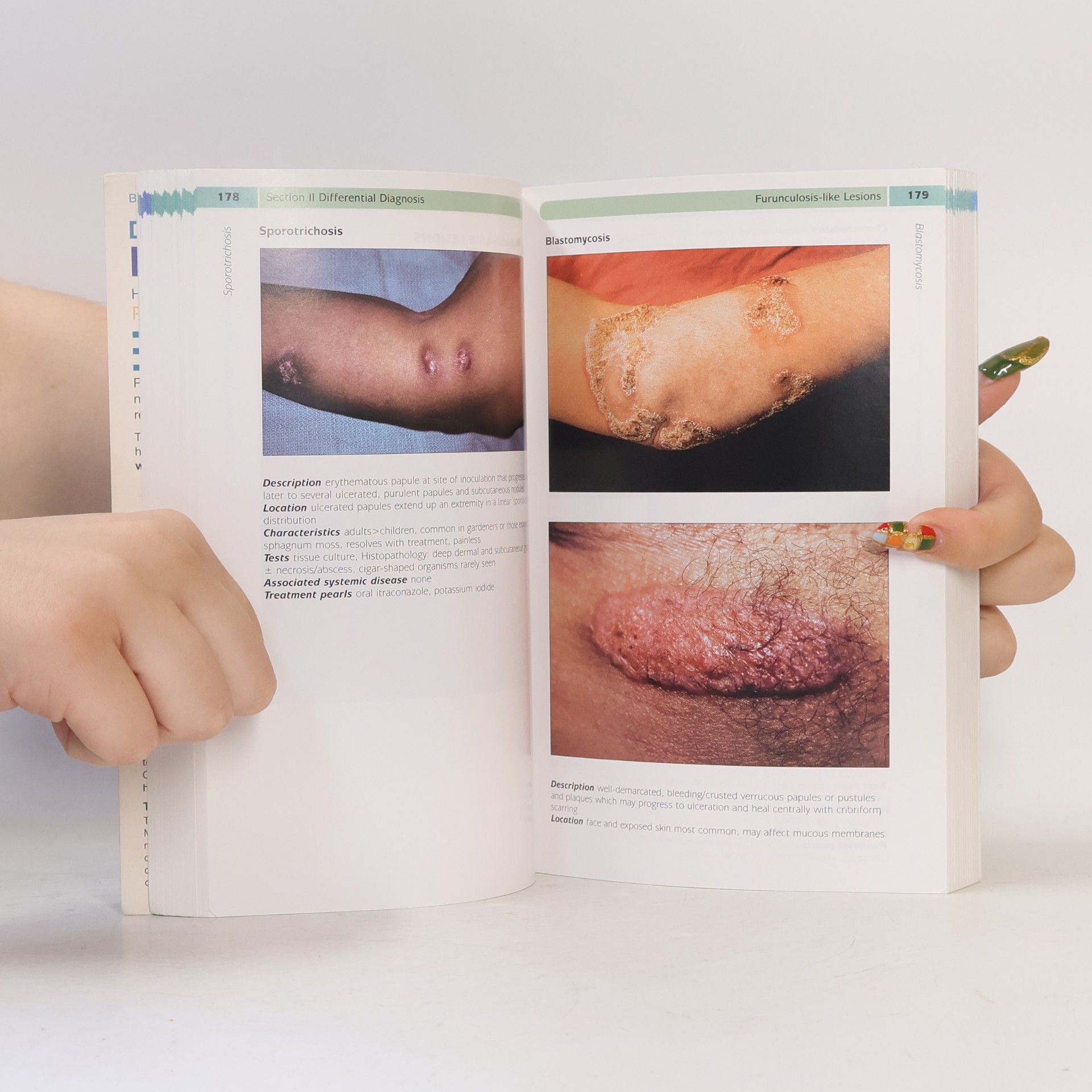 Lauren Hughey Differential Diagnosis in Dermatology