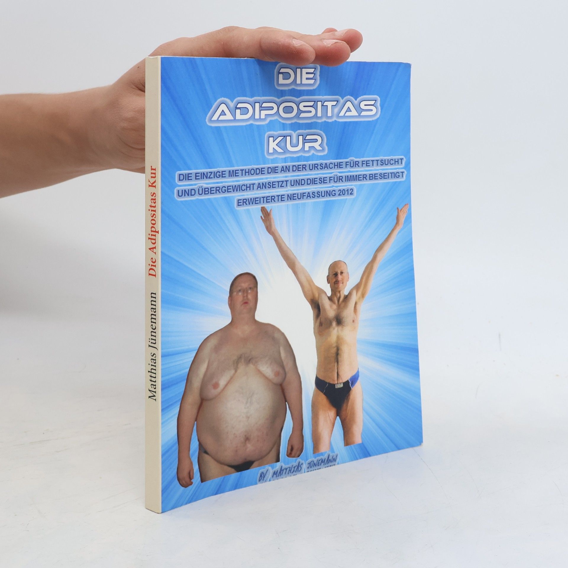 Matthias Jünemann Die Adipositas-Kur