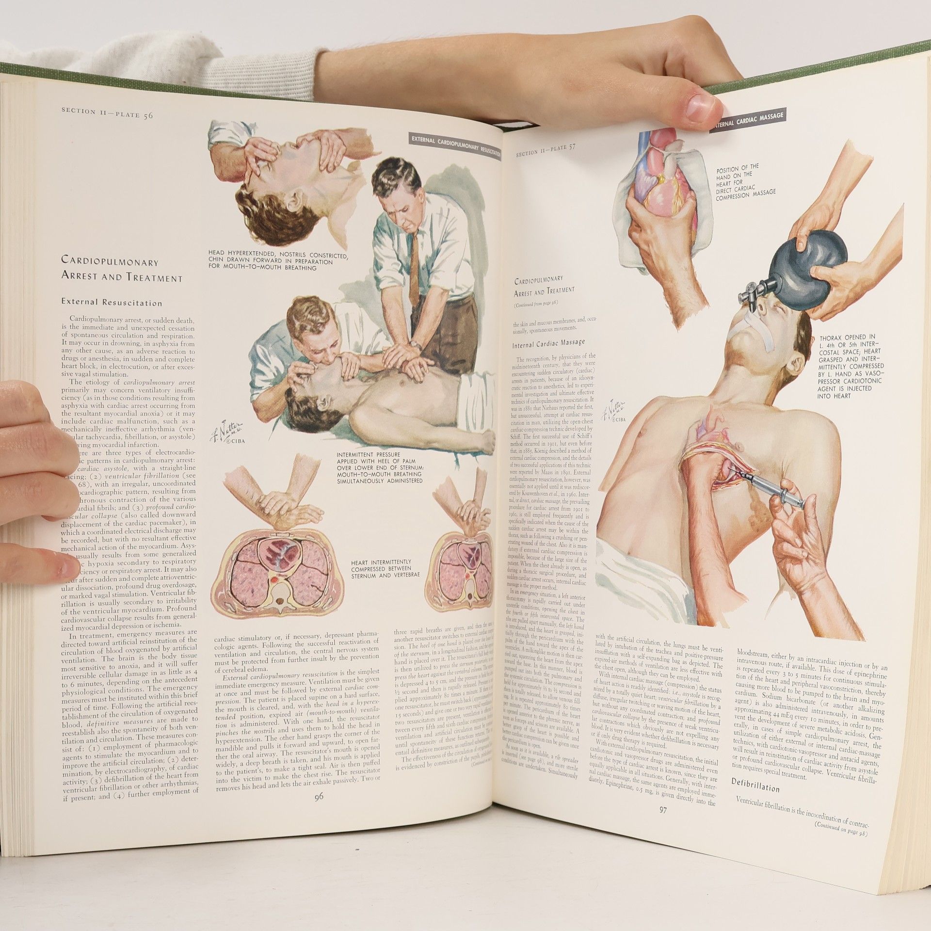 Frank H. Netter The Ciba Collection of Medical Illustrations. Volume 5. Heart