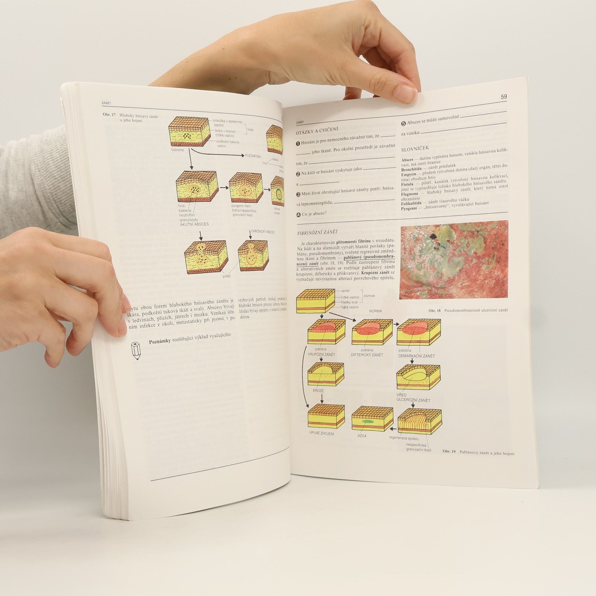 Jan Stříteský Patologie pro 2. ročník středních zdravotnických škol 1.díl