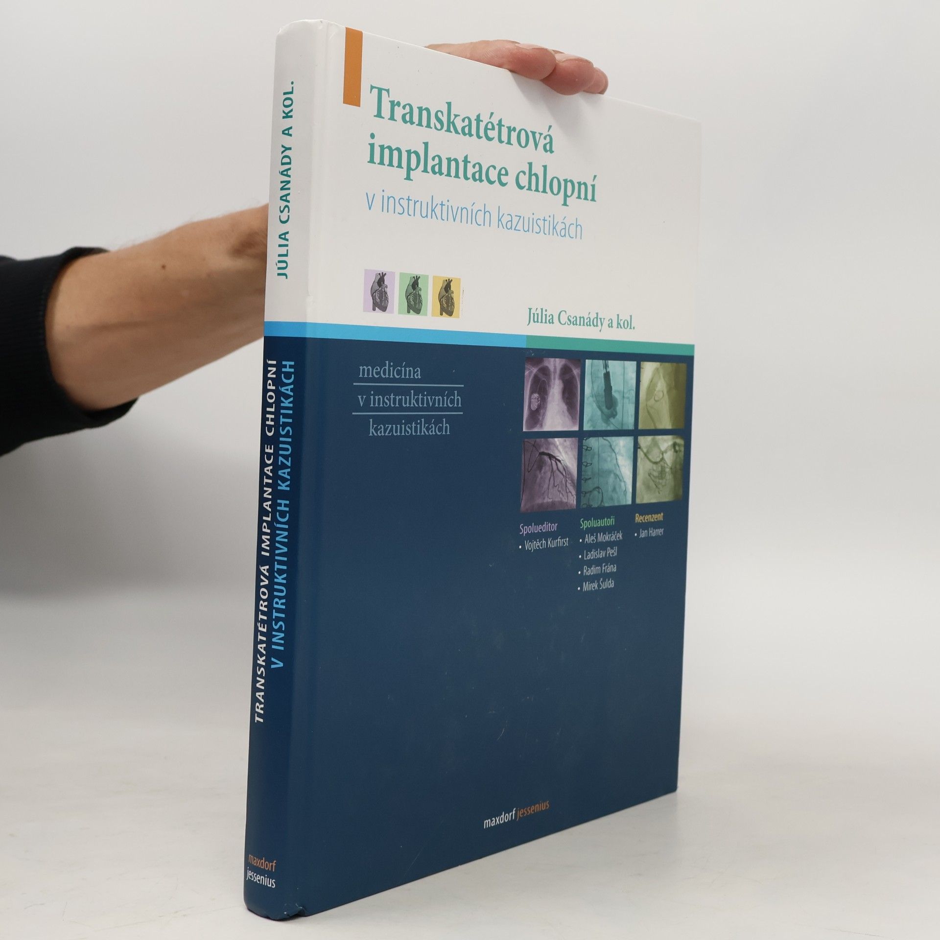 Júlia Csanády Transkatétrová implantace chlopní v instruktivních kazuistikách