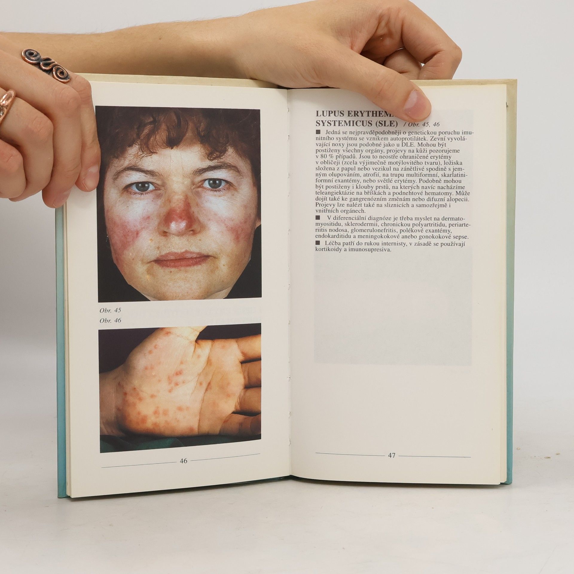 Pavel Barták Dermatologie. Obrazové repetitorium