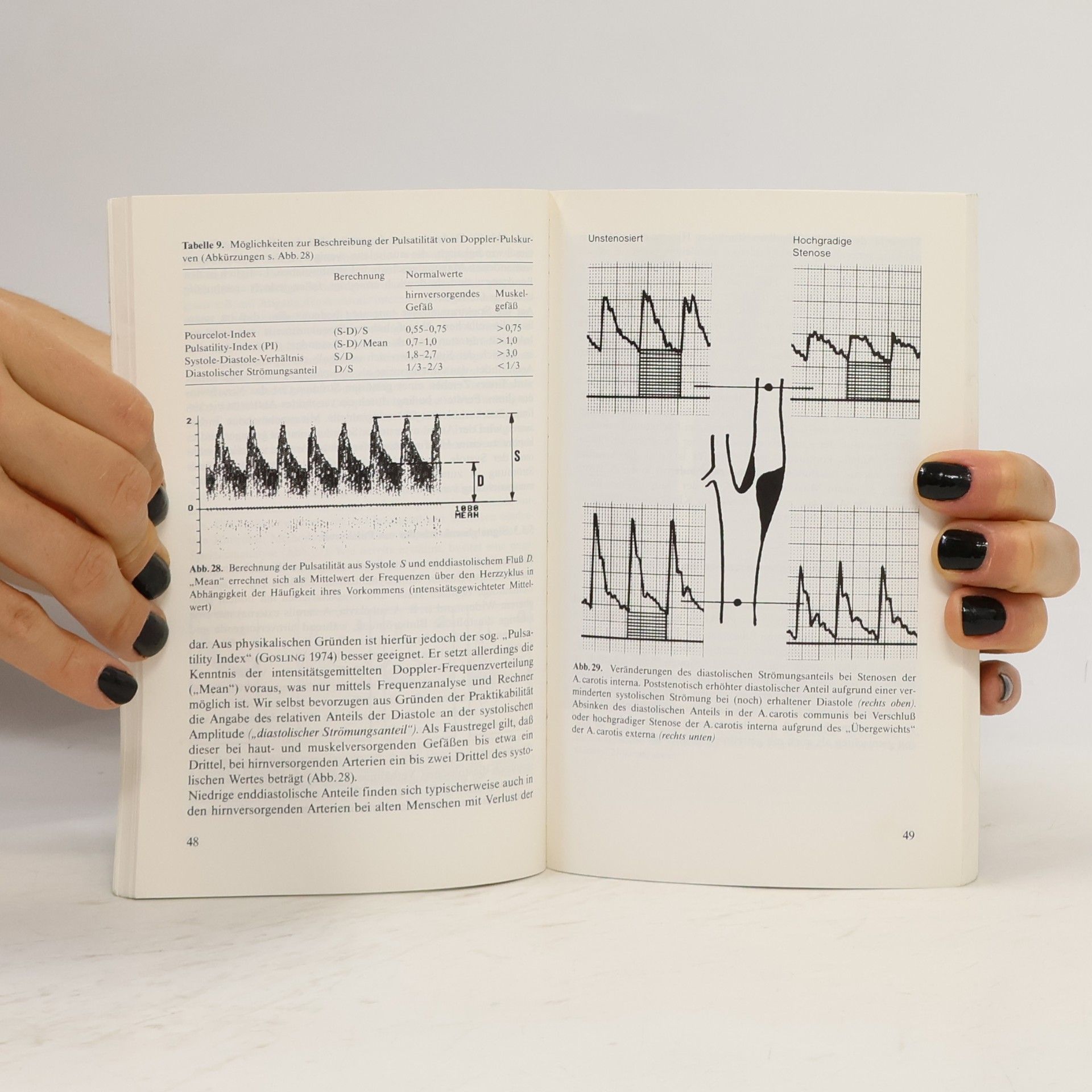 Bernhard Widder Doppler- und Duplexsonographie der hirnversorgenden Arterien
